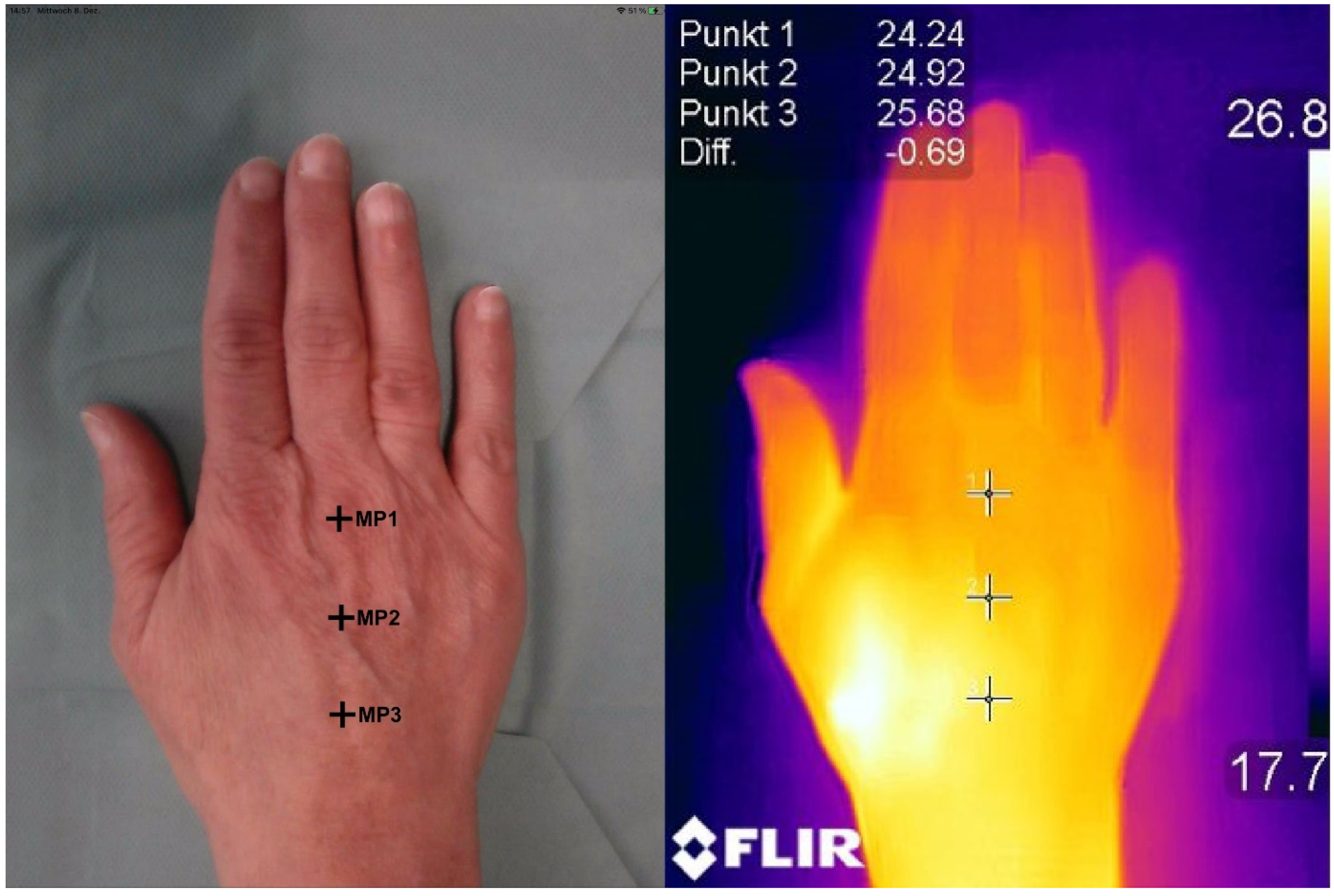 Jcm 11 05240 g003 Jcm 11 05240 g003
