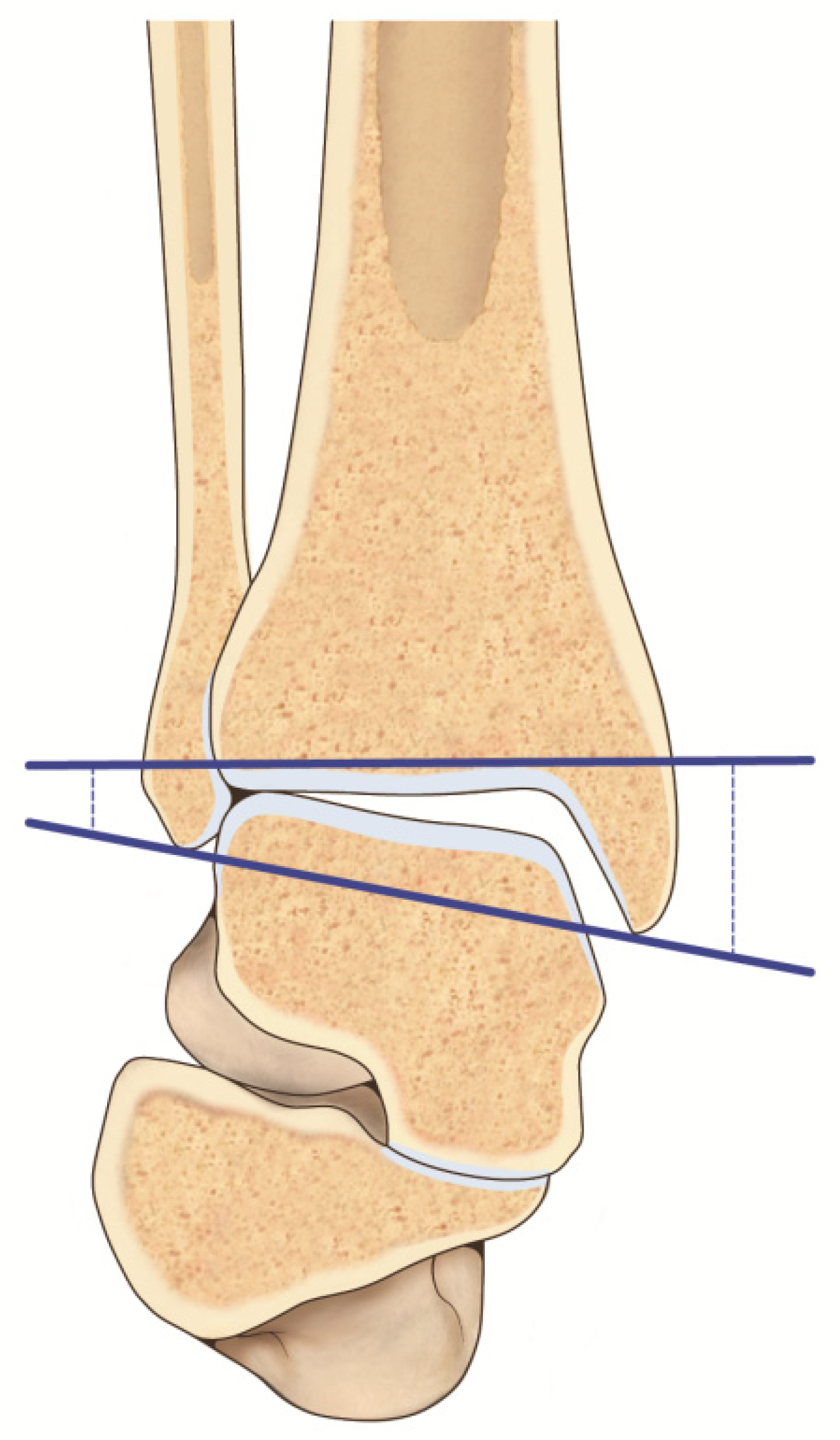 The deltoid ligament: an in-depth review of anatomy, function, and