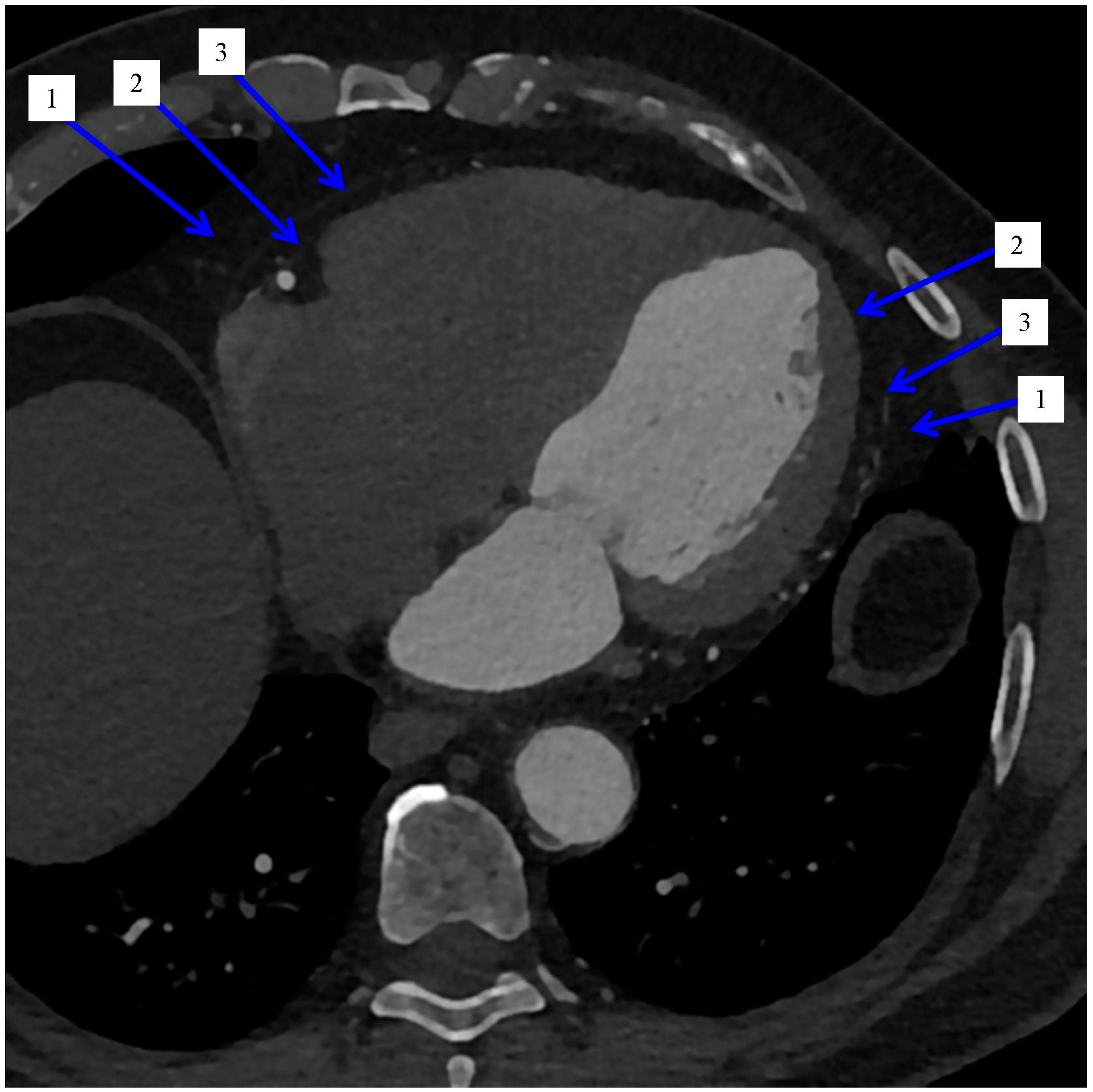Jcm 11 05621 g001 Jcm 11 05621 g001