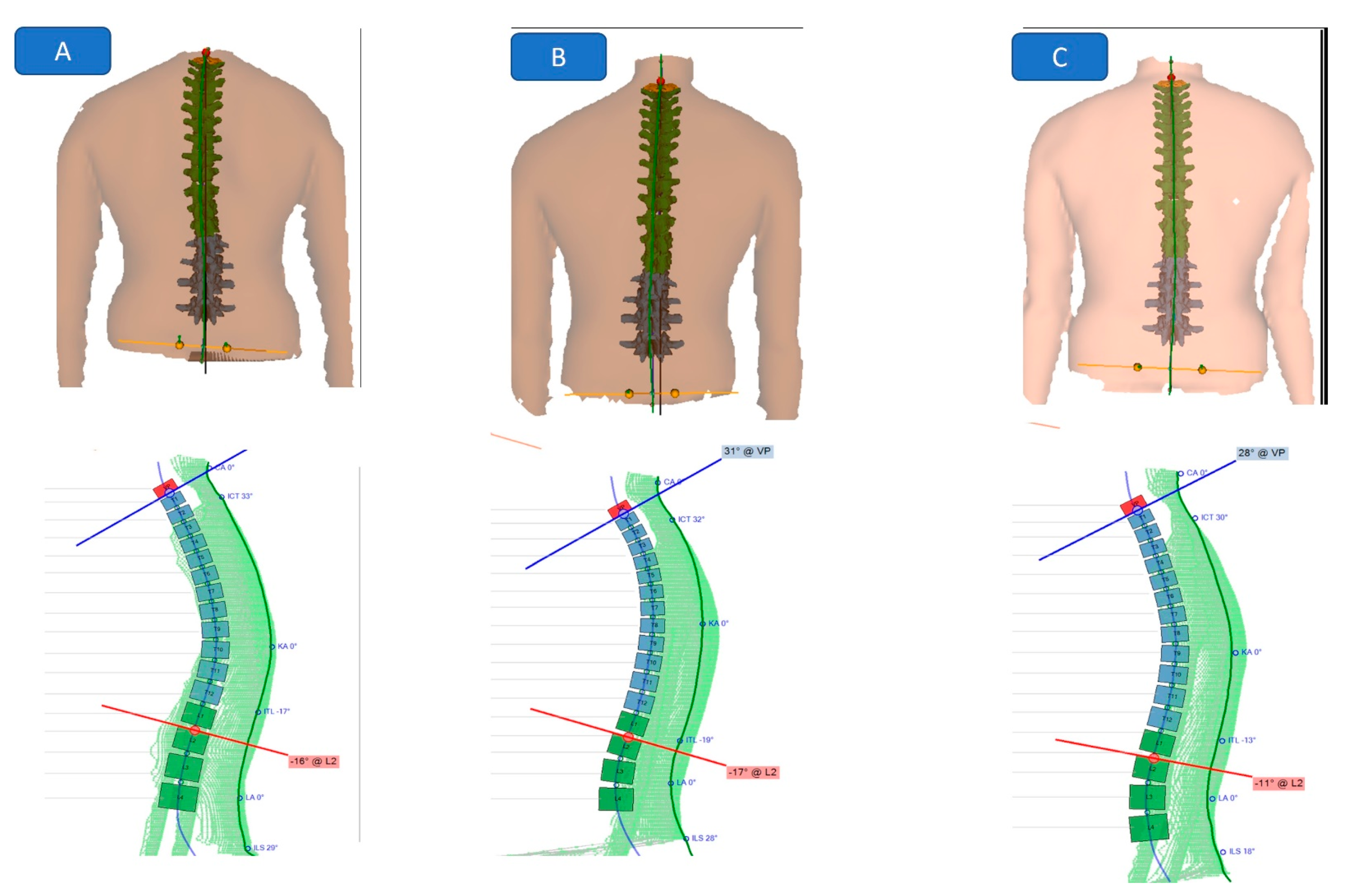 JCM | Free Full-Text | Does Improvement Towards A Normal Cervical ...