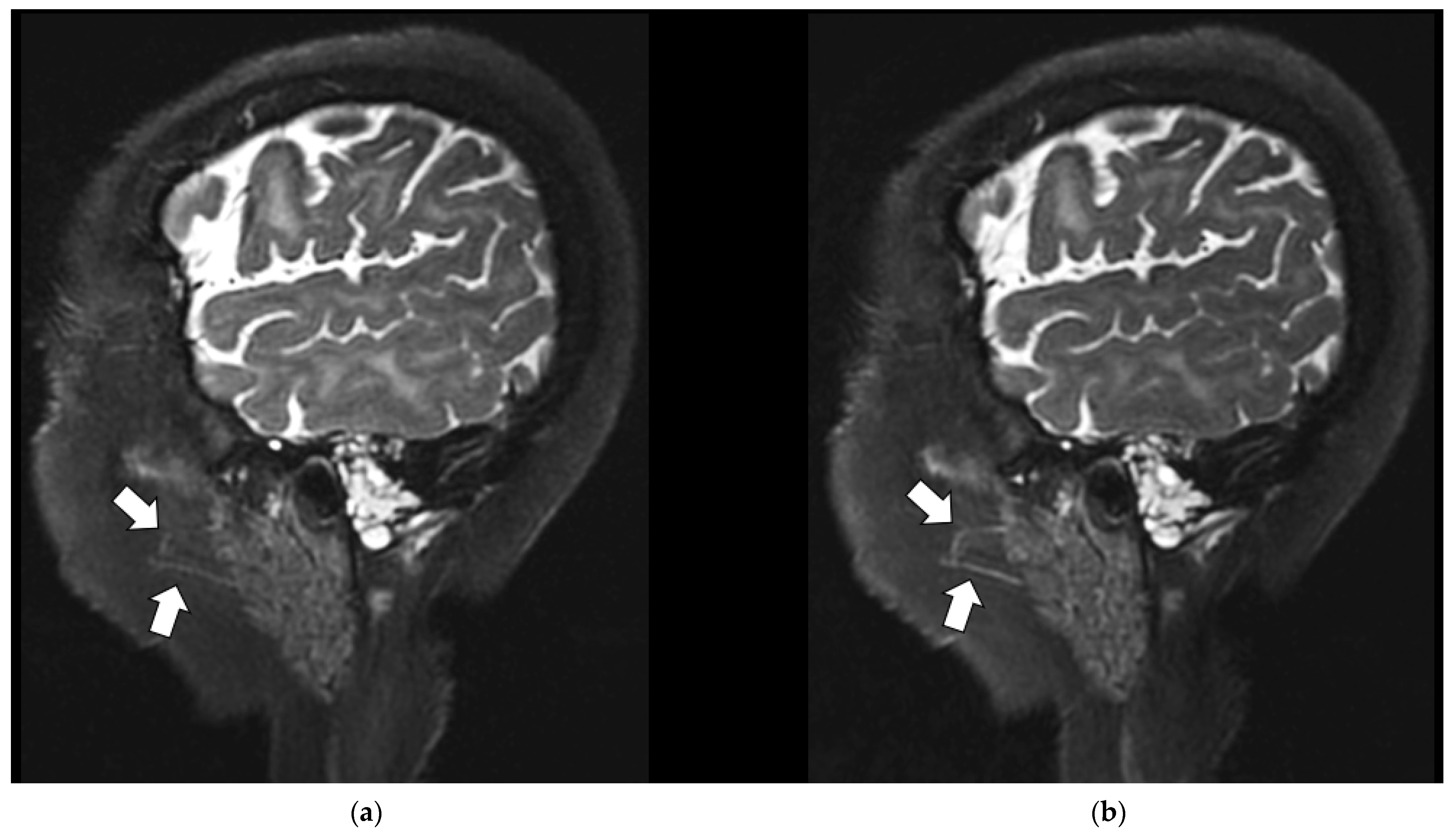 Jcm 11 05984 g009 Jcm 11 05984 g009
