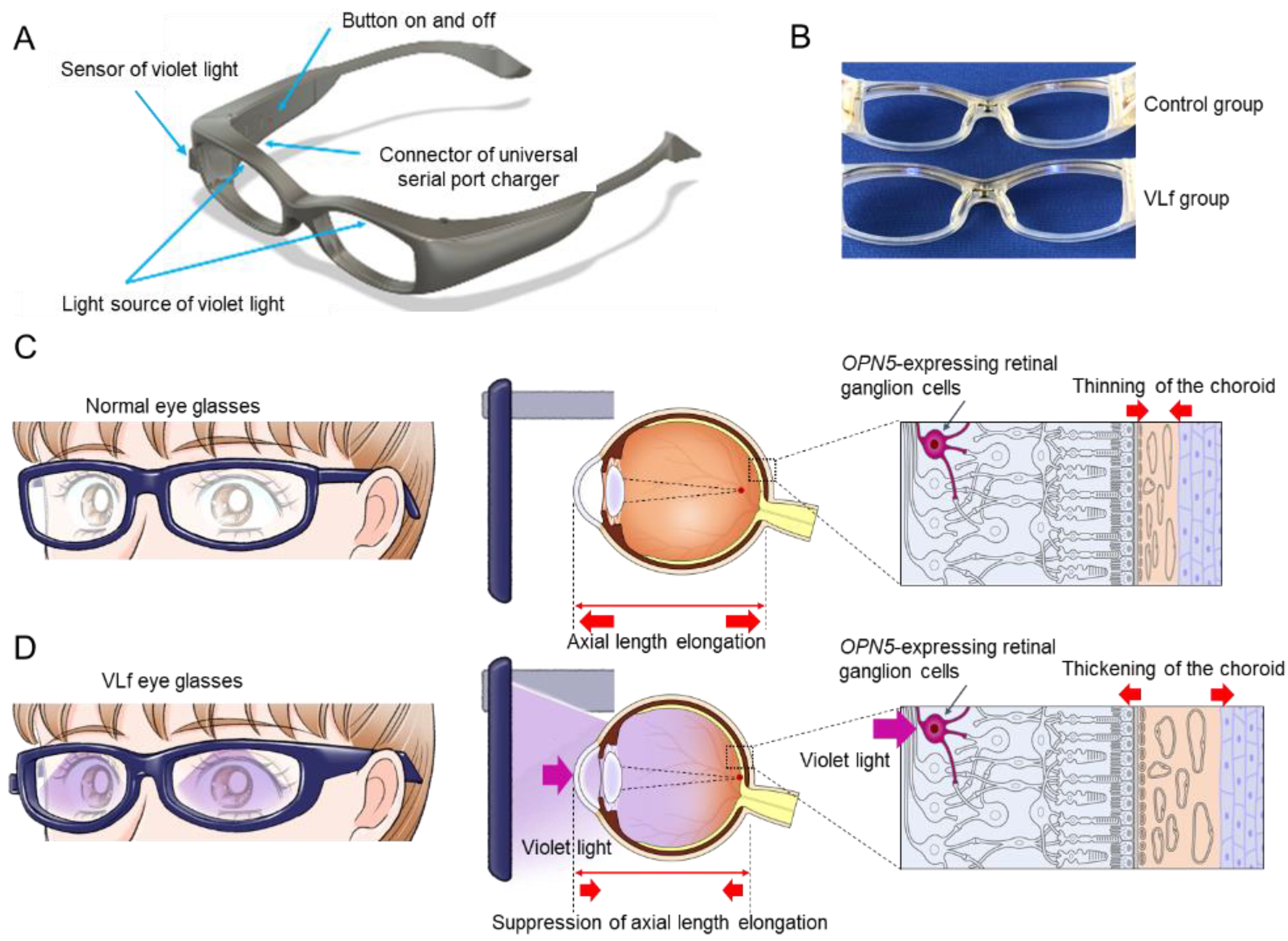 JCM | Free Full-Text | Short-Term Exposure to Violet Light Emitted from  Eyeglass Frames in Myopic Children: A Randomized Pilot Clinical Trial