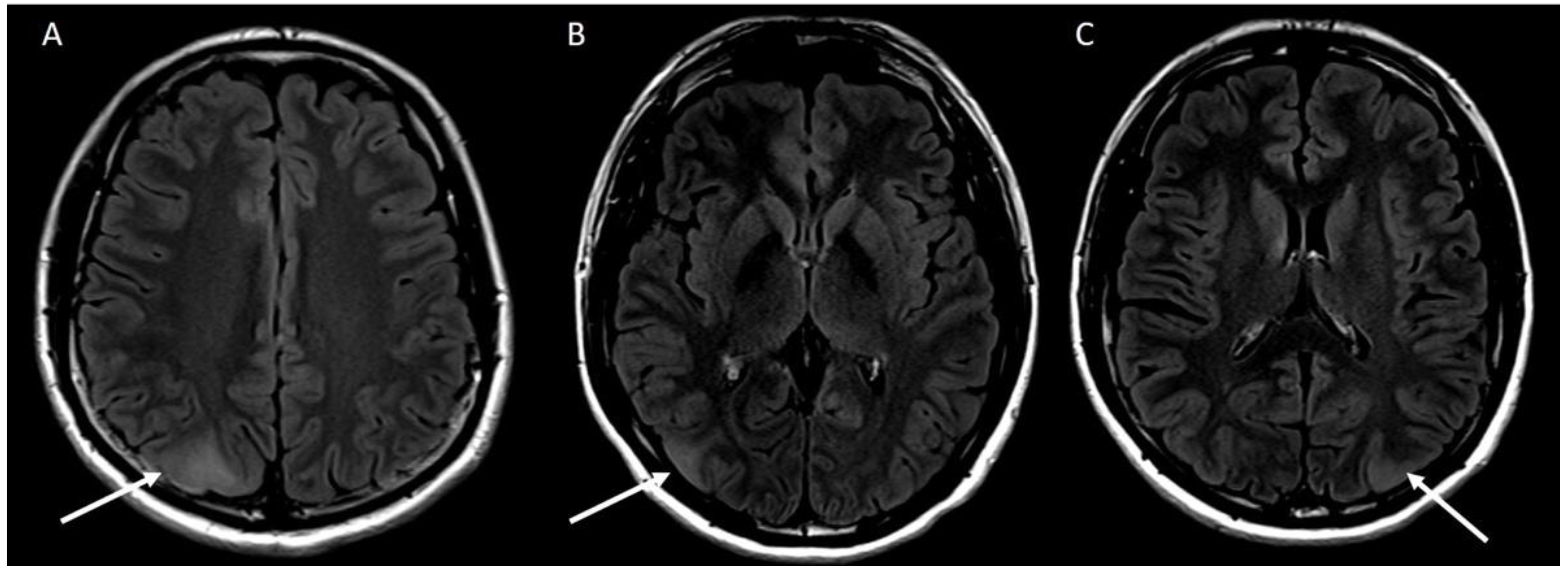Jcm 11 06084 g002 Jcm 11 06084 g002