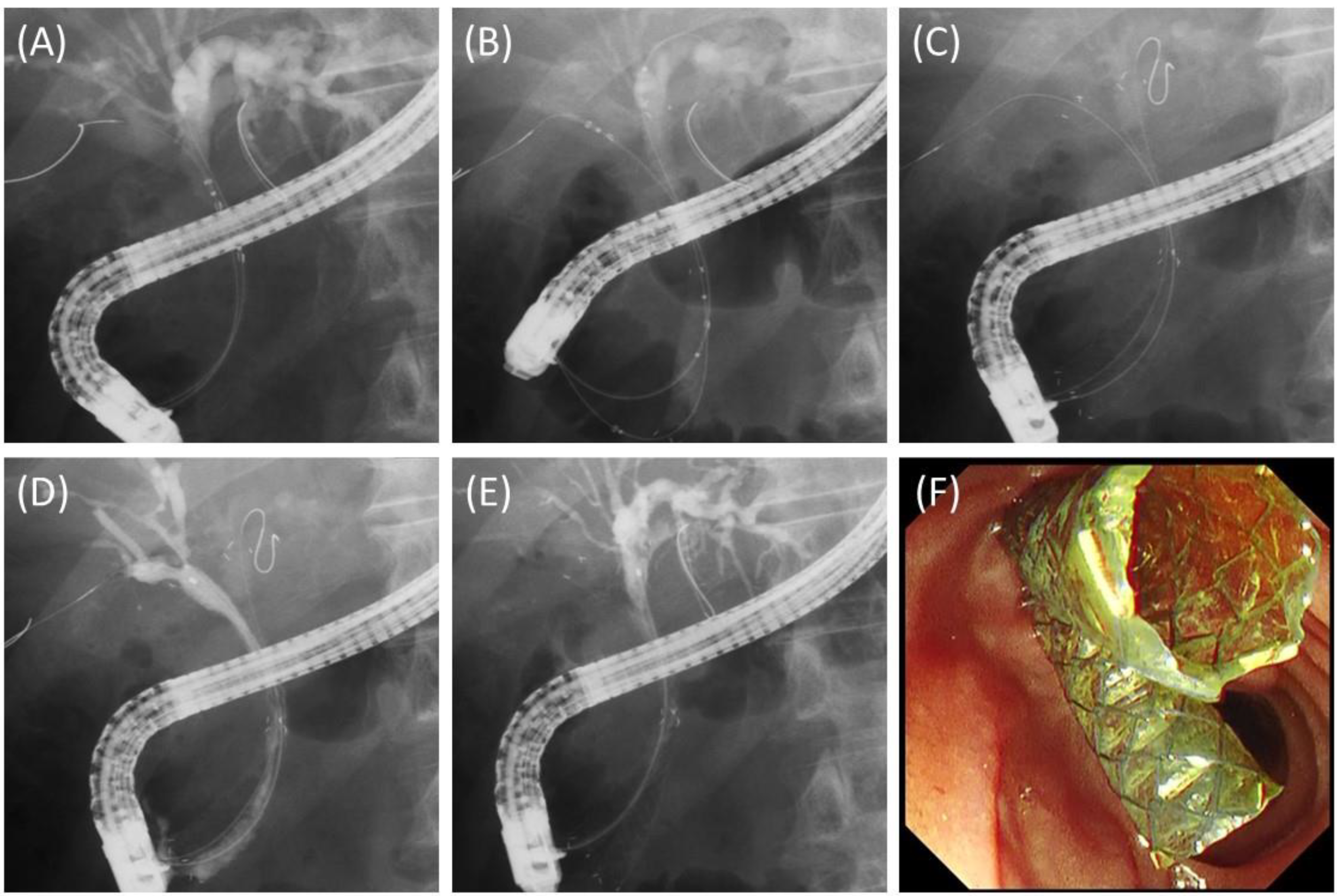 Jcm 11 06110 g002 Jcm 11 06110 g002