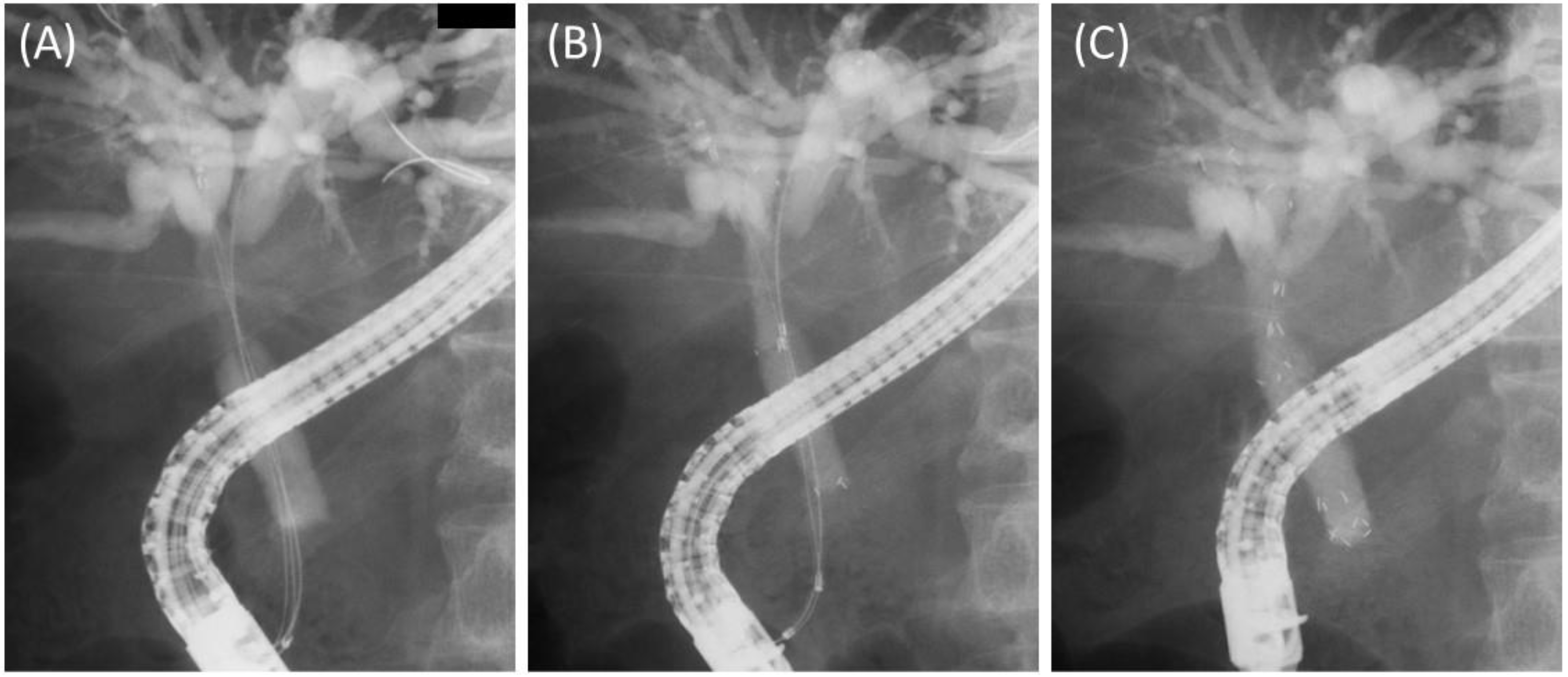 Jcm 11 06110 g003 Jcm 11 06110 g003