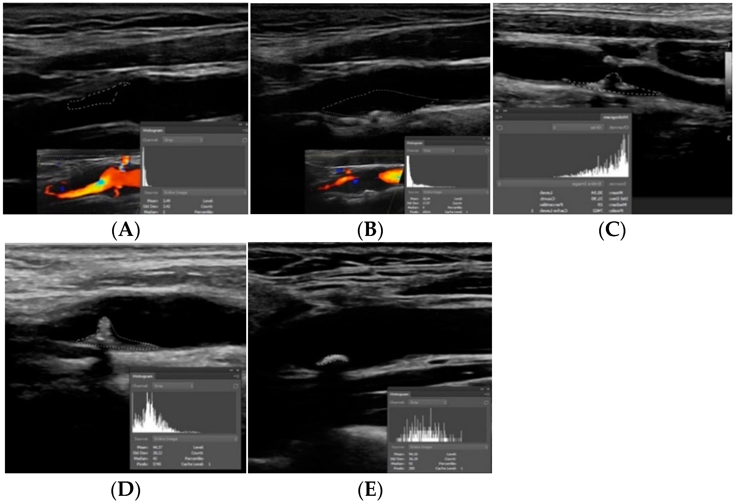 Jcm 11 06196 g002 Jcm 11 06196 g002