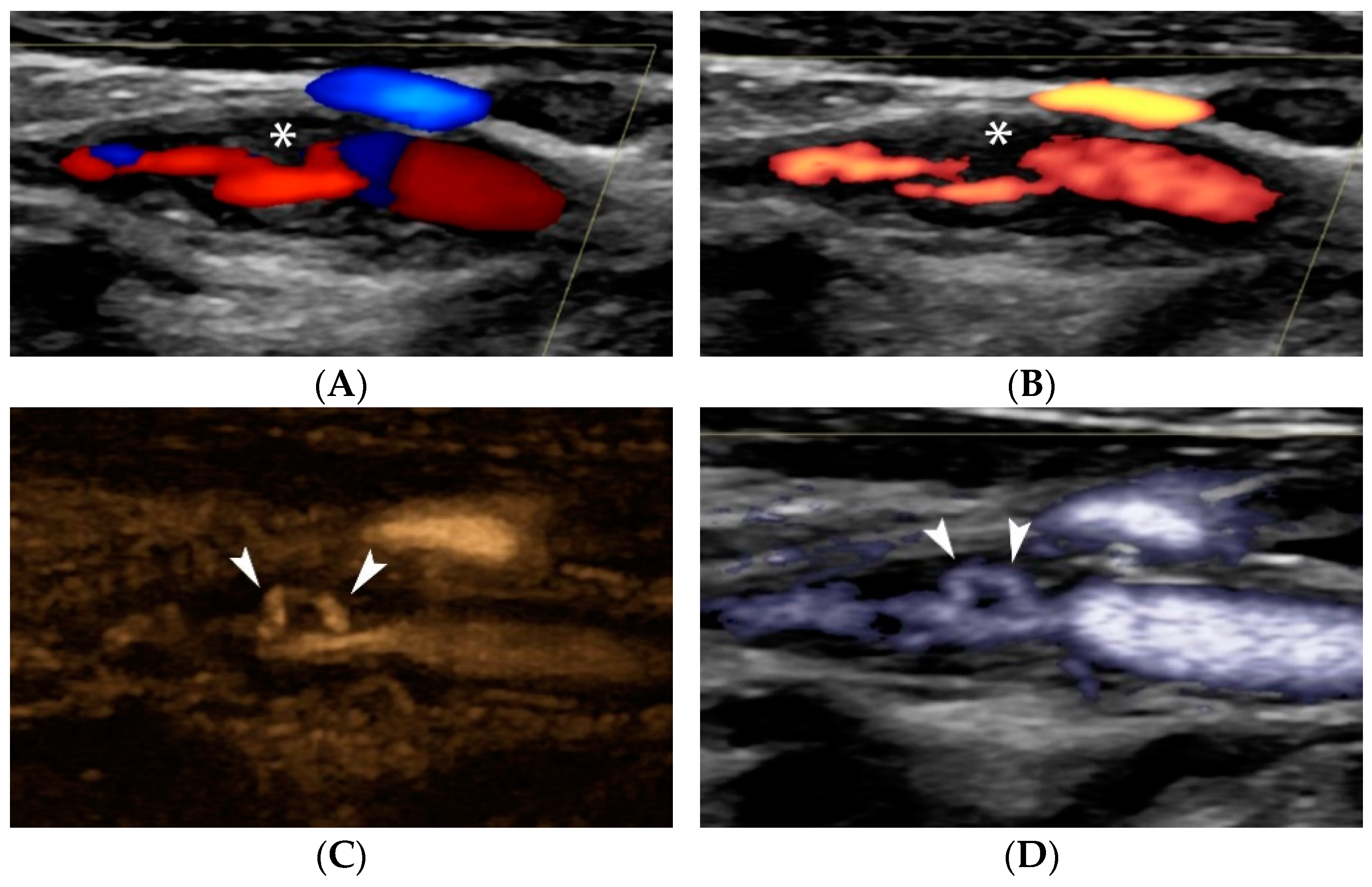 Jcm 11 06196 g006a Jcm 11 06196 g006a