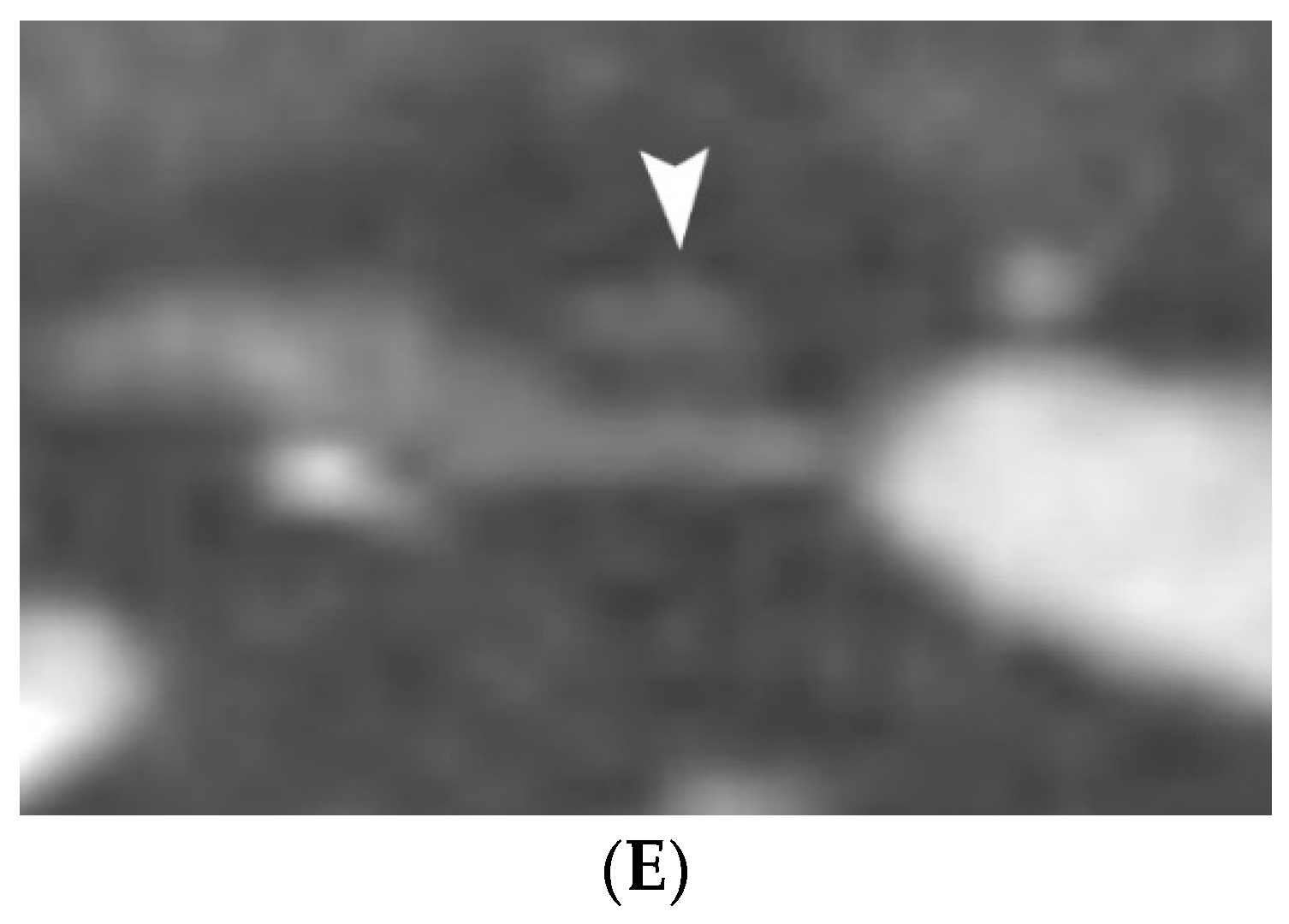 Jcm 11 06196 g006b Jcm 11 06196 g006b