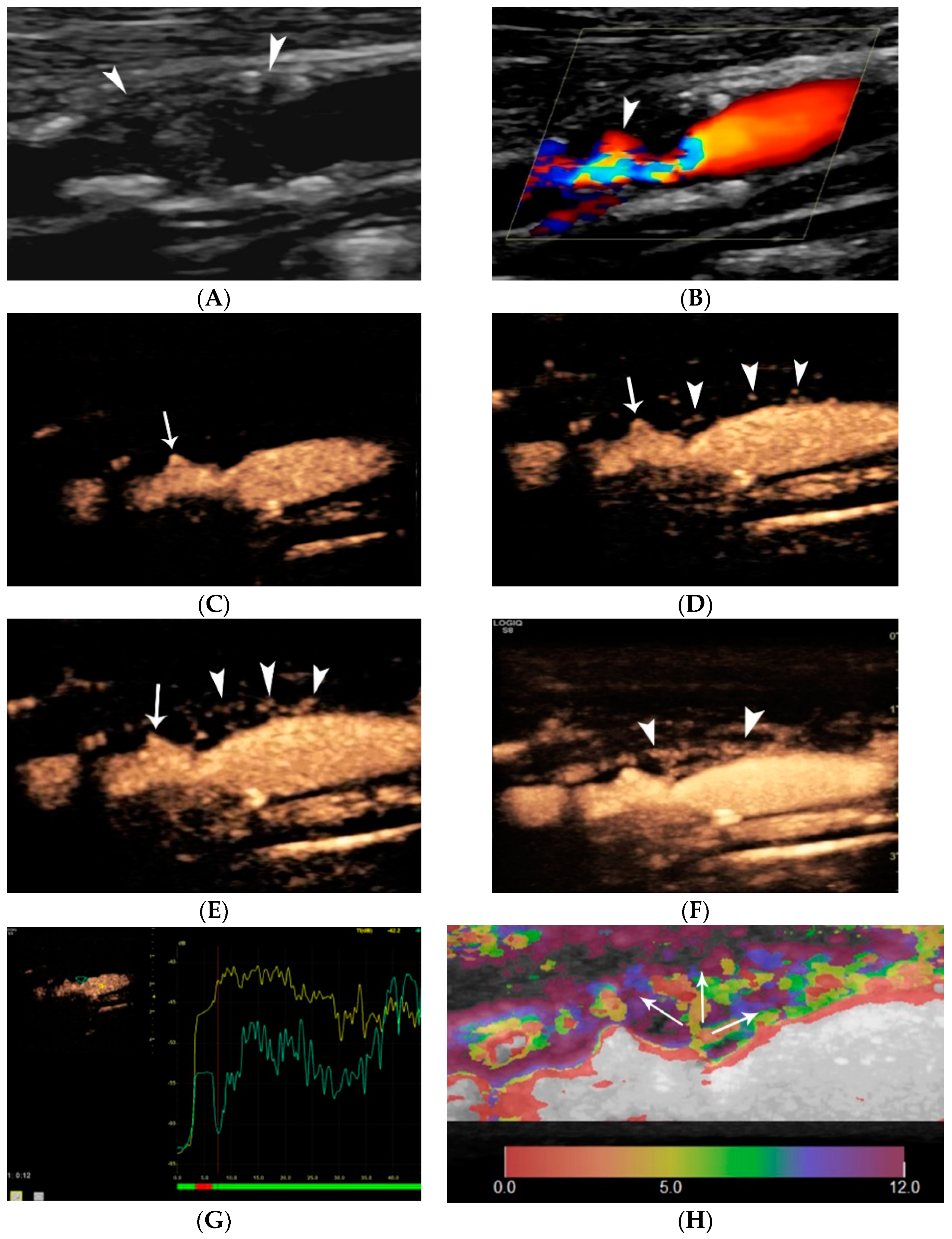 Jcm 11 06196 g009 Jcm 11 06196 g009