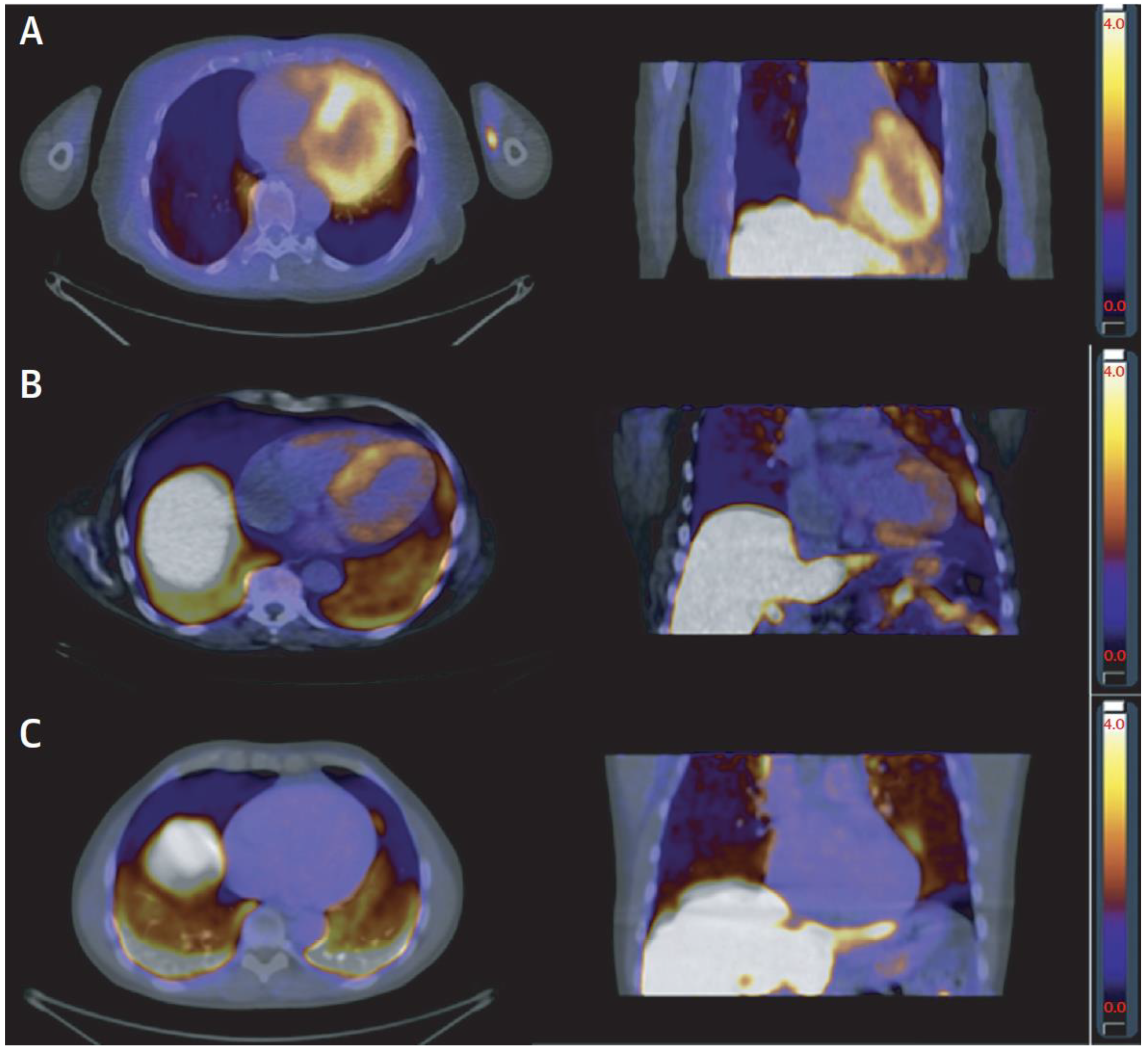 Jcm 11 06201 g006 Jcm 11 06201 g006