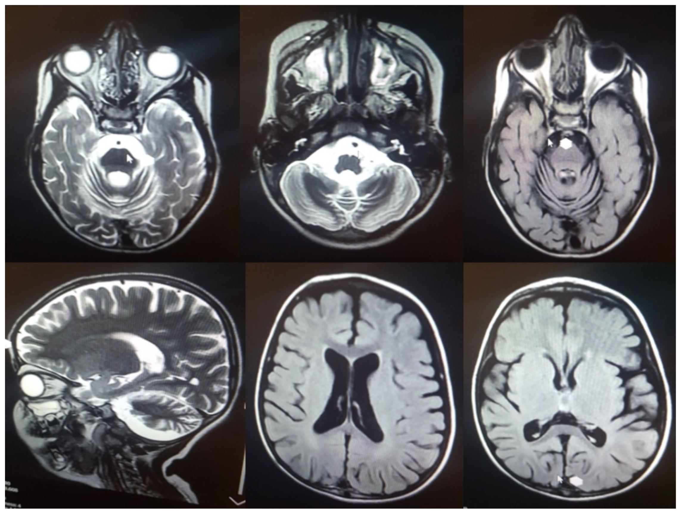 Jcm 11 06415 g004 Jcm 11 06415 g004