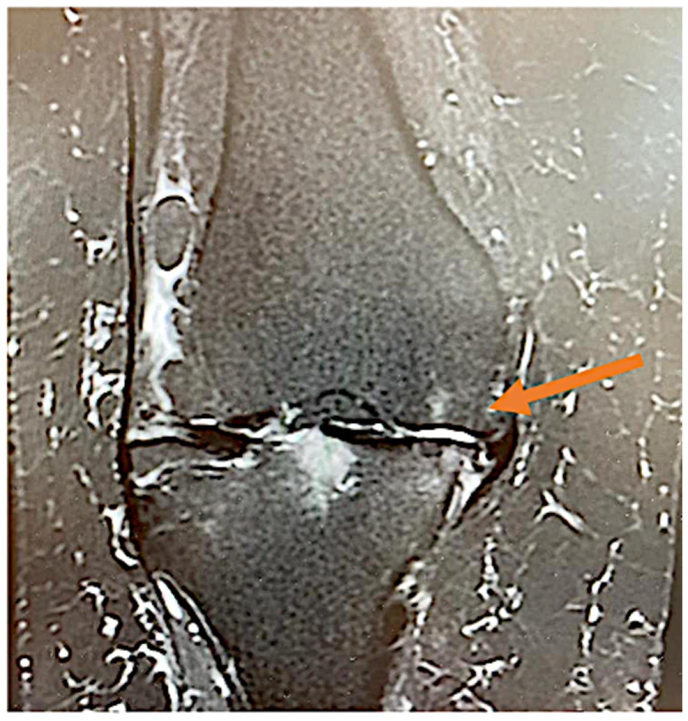 Jcm 11 06573 g002 Jcm 11 06573 g002