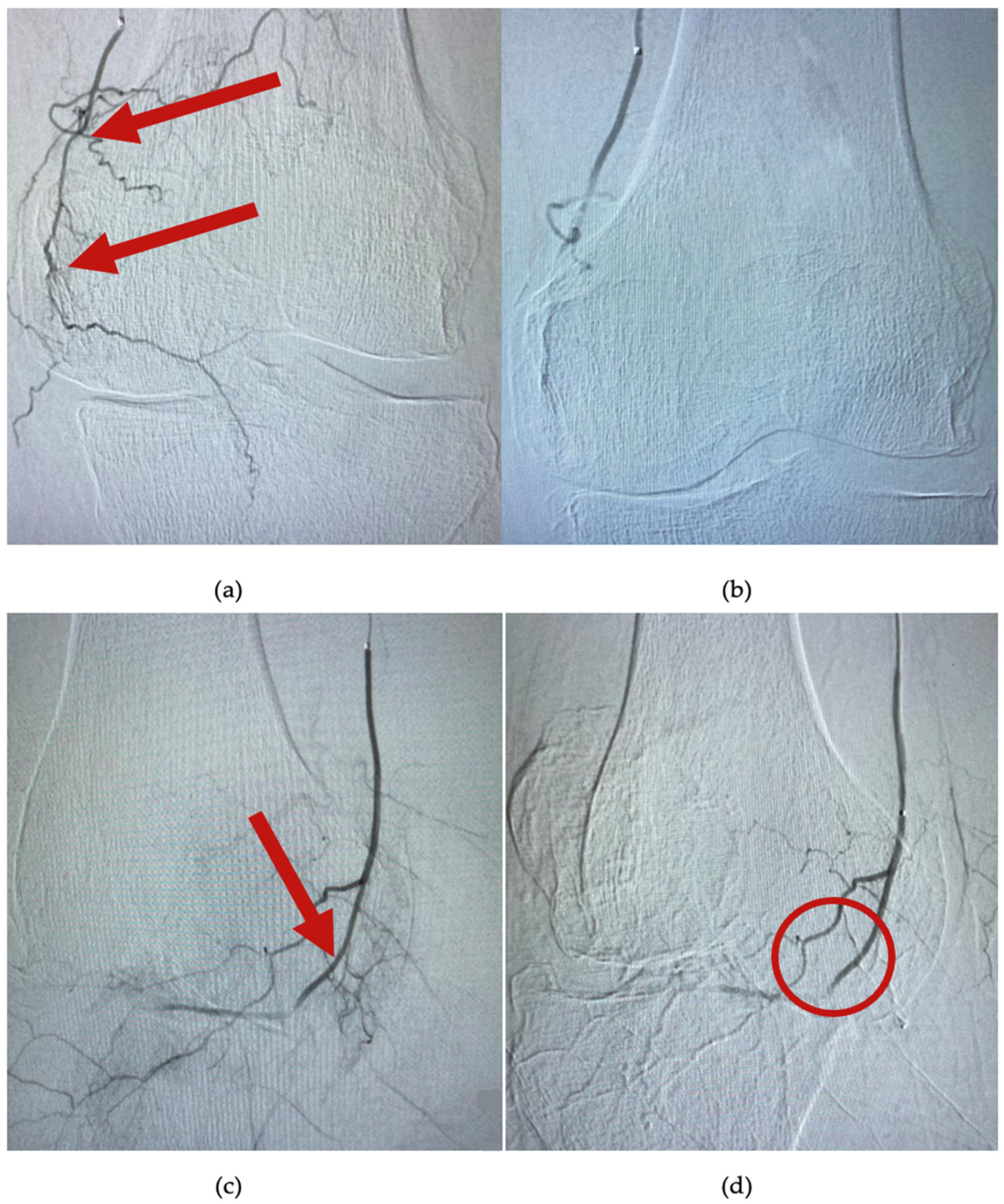 Jcm 11 06573 g003 Jcm 11 06573 g003