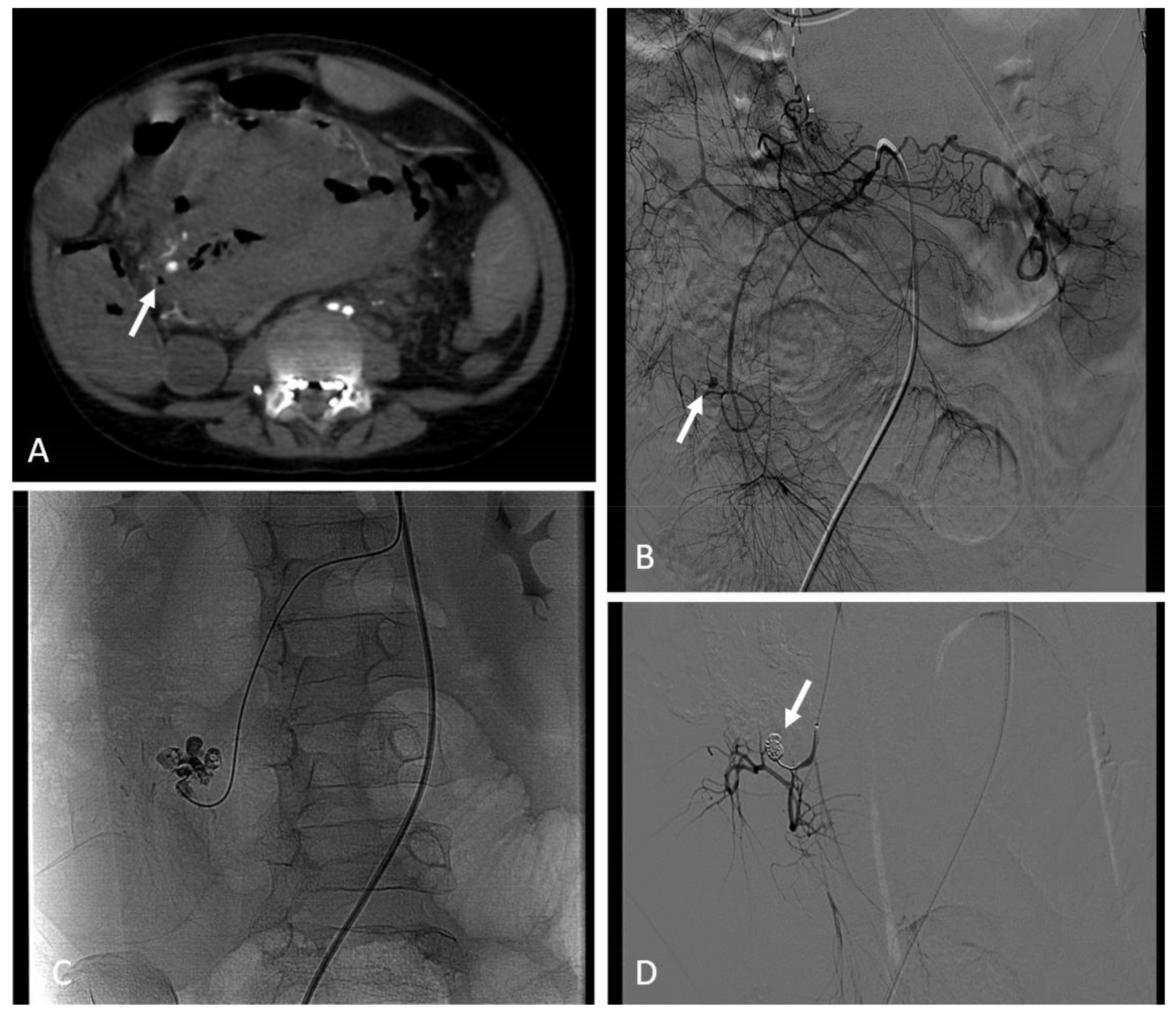 Jcm 11 06626 g003 Jcm 11 06626 g003