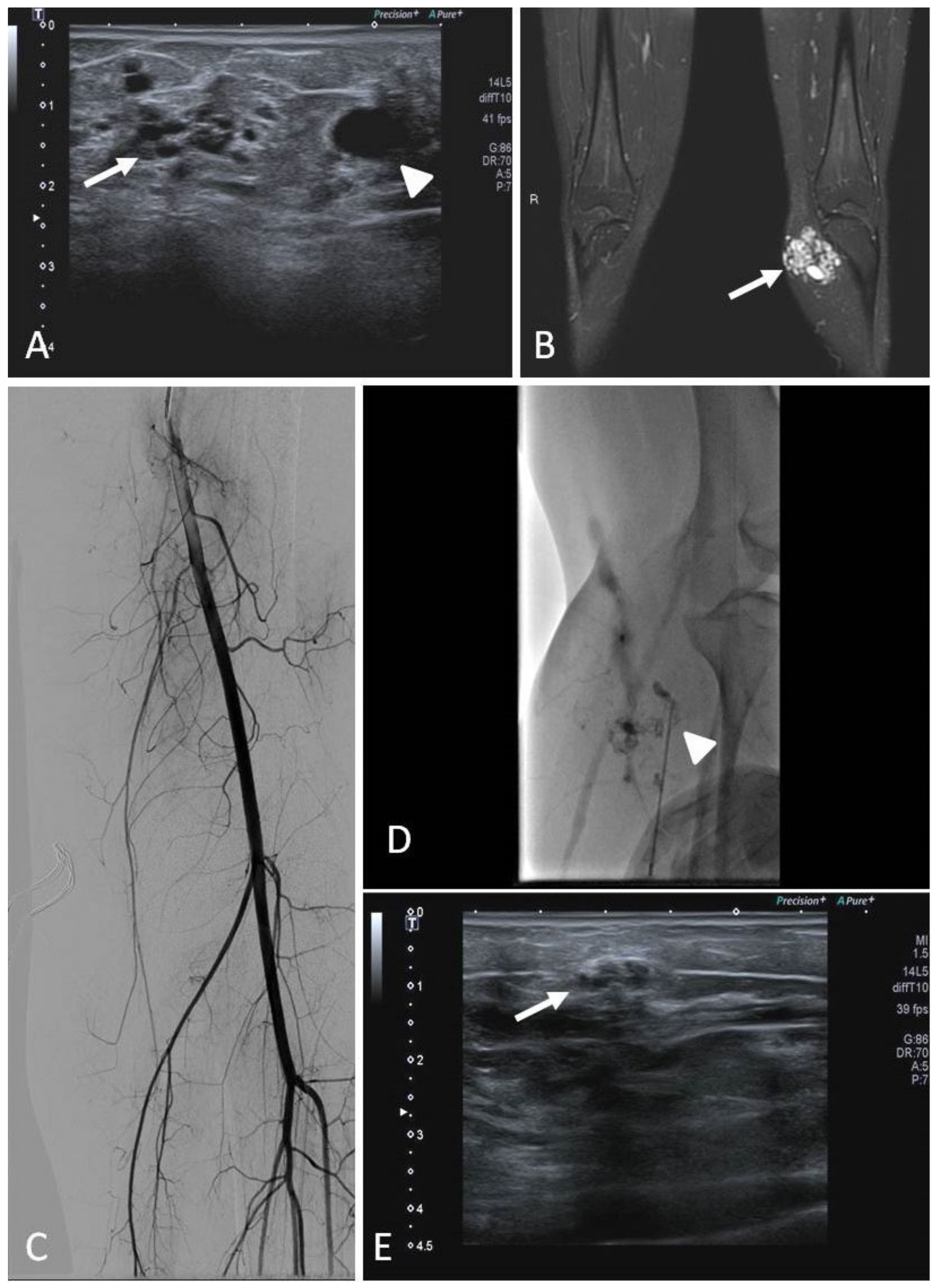 Jcm 11 06626 g006 Jcm 11 06626 g006