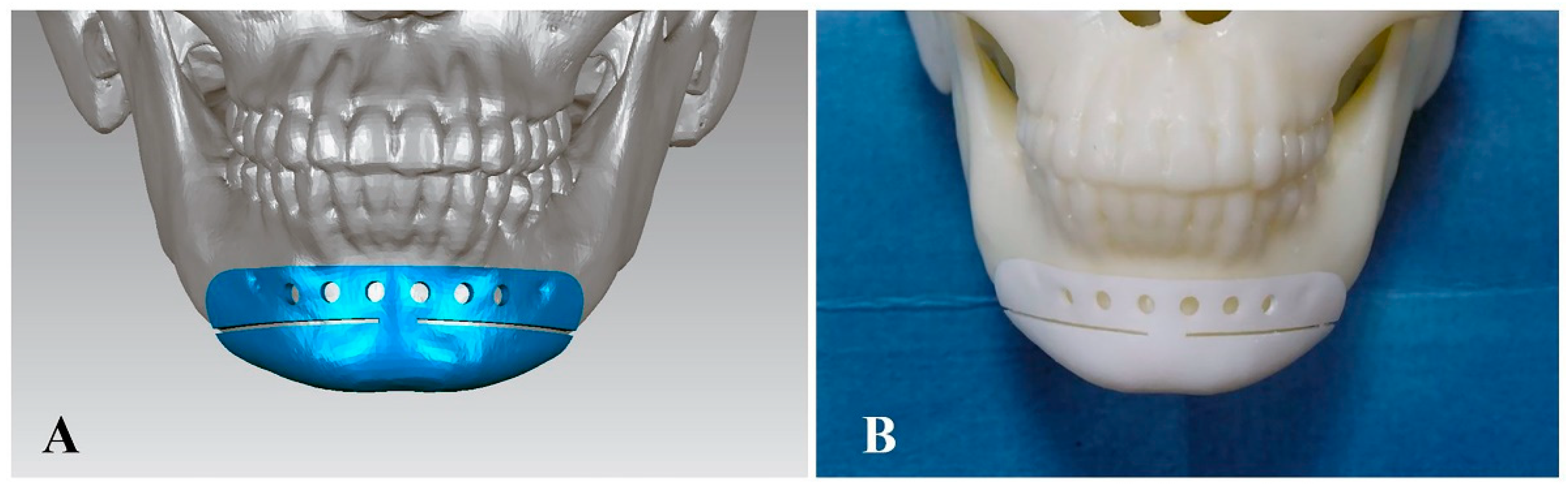 Jcm 11 06807 g003 Jcm 11 06807 g003