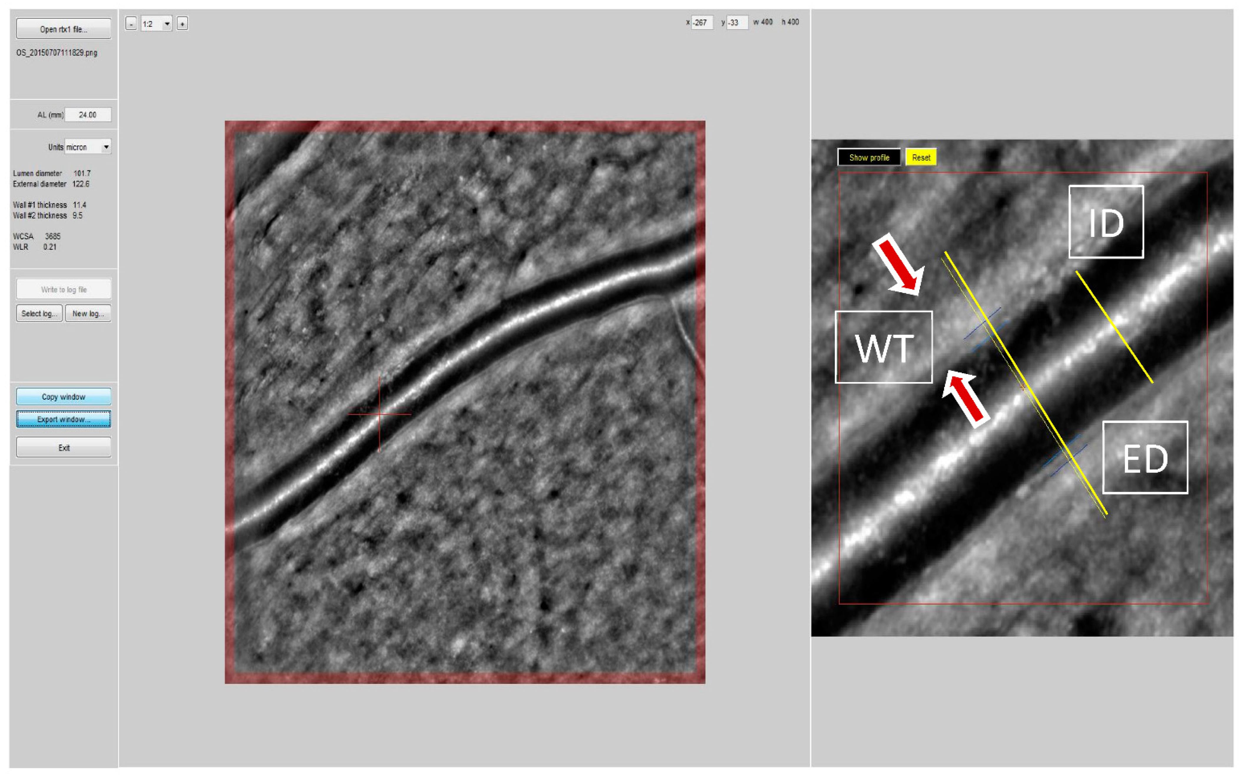 https://www.mdpi.com/jcm/jcm-11-06966/article_deploy/html/images/jcm-11-06966-g001.png