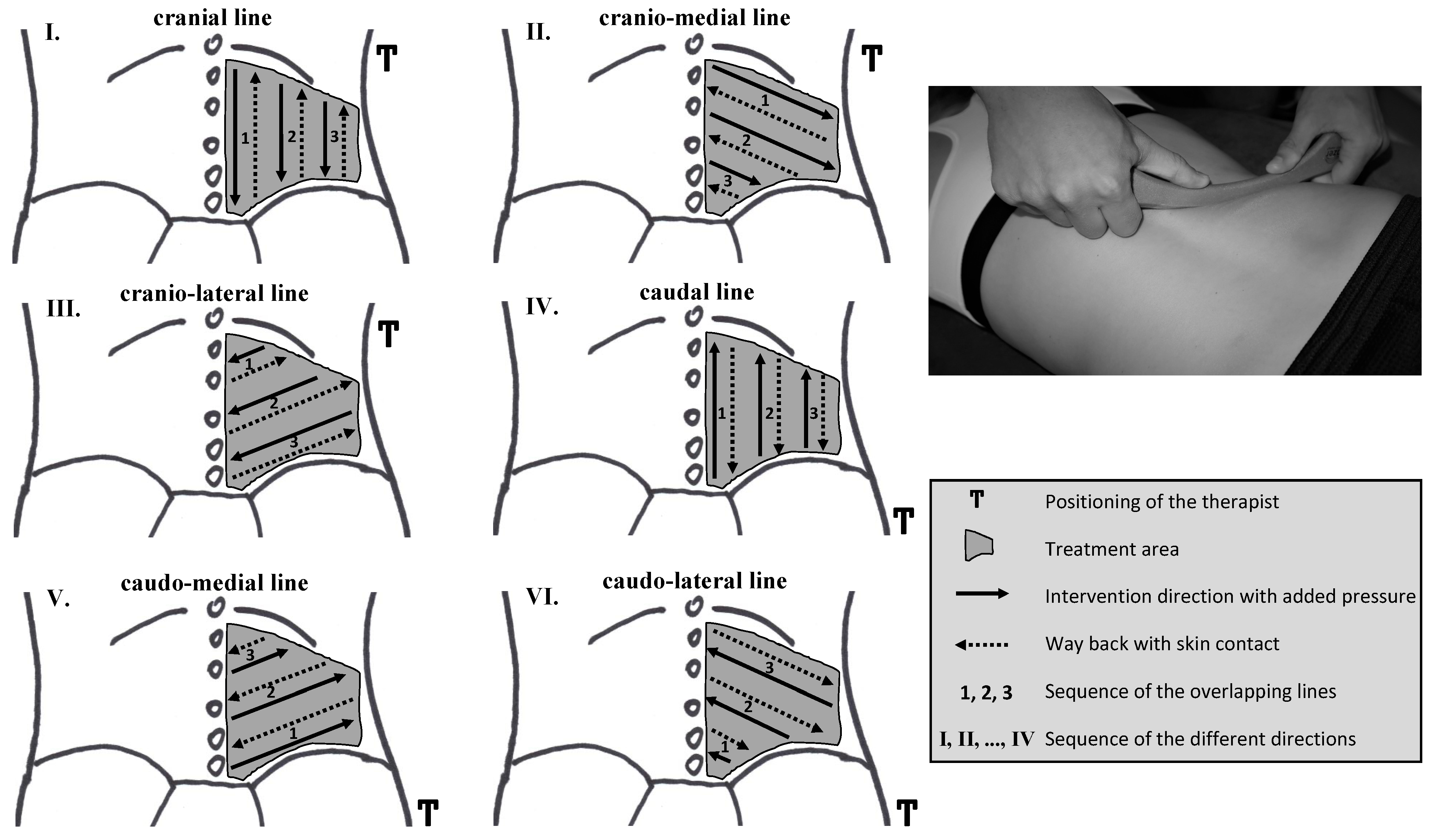 JCM | Free Full-Text | The Influence of a Single Instrument-Assisted Manual  Therapy (IAMT) for the Lower Back on the Structural and Functional  Properties of the Dorsal Myofascial Chain in Female Soccer