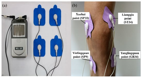 Why Does Adding Electricity to Dry Needling Make It More Effective? -  Western Slope Rehab & Performance