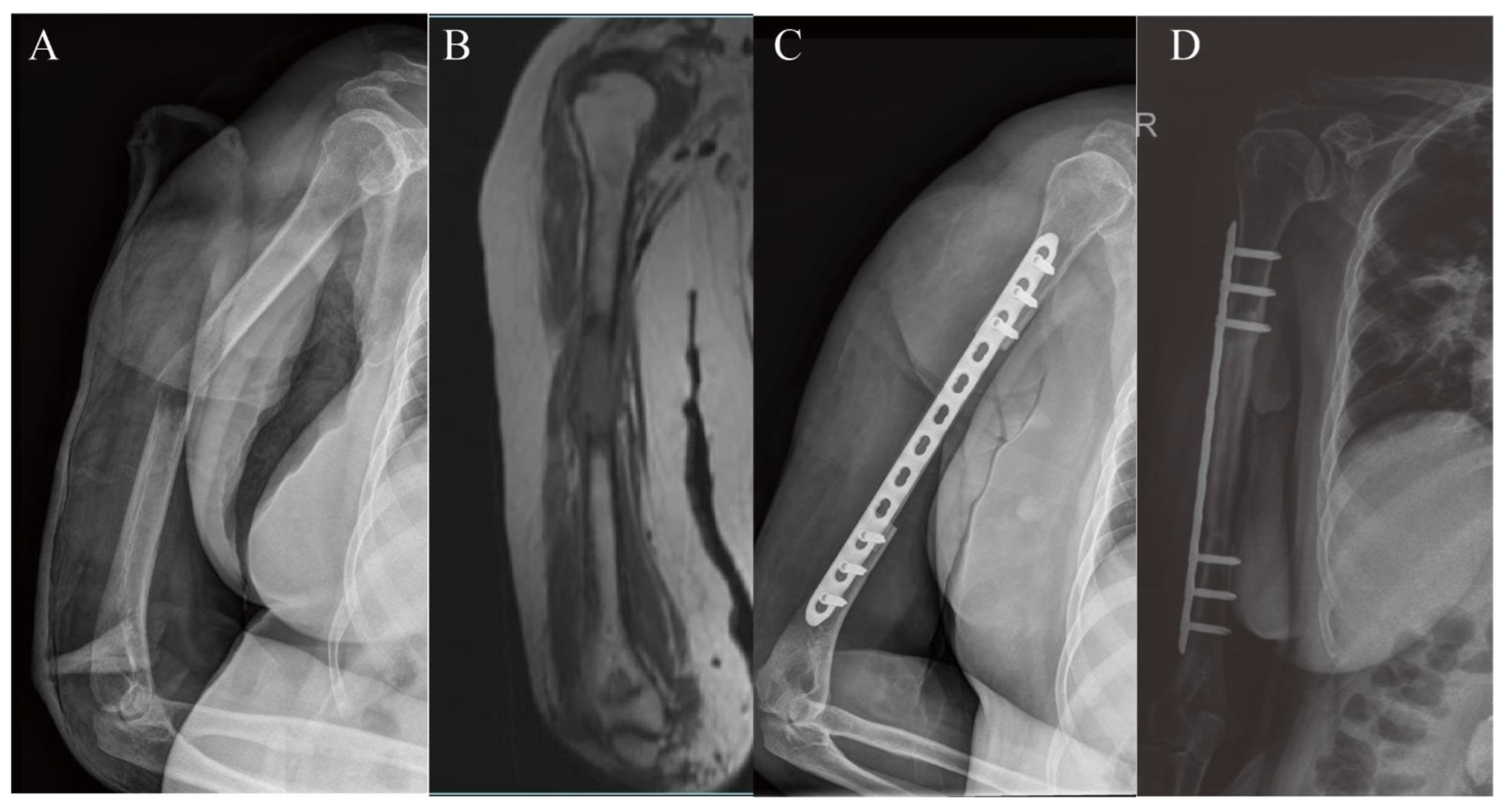 Jcm 11 07225 g003 Jcm 11 07225 g003