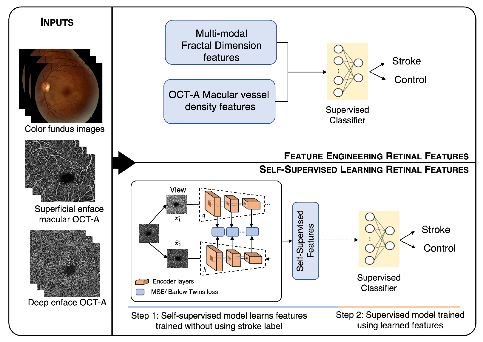 Retina Workflow