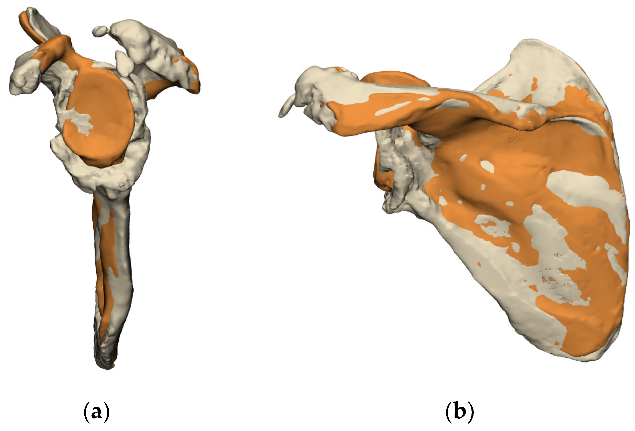 Blog – tagged Shoulder Surgery – Page 2 – Springrose