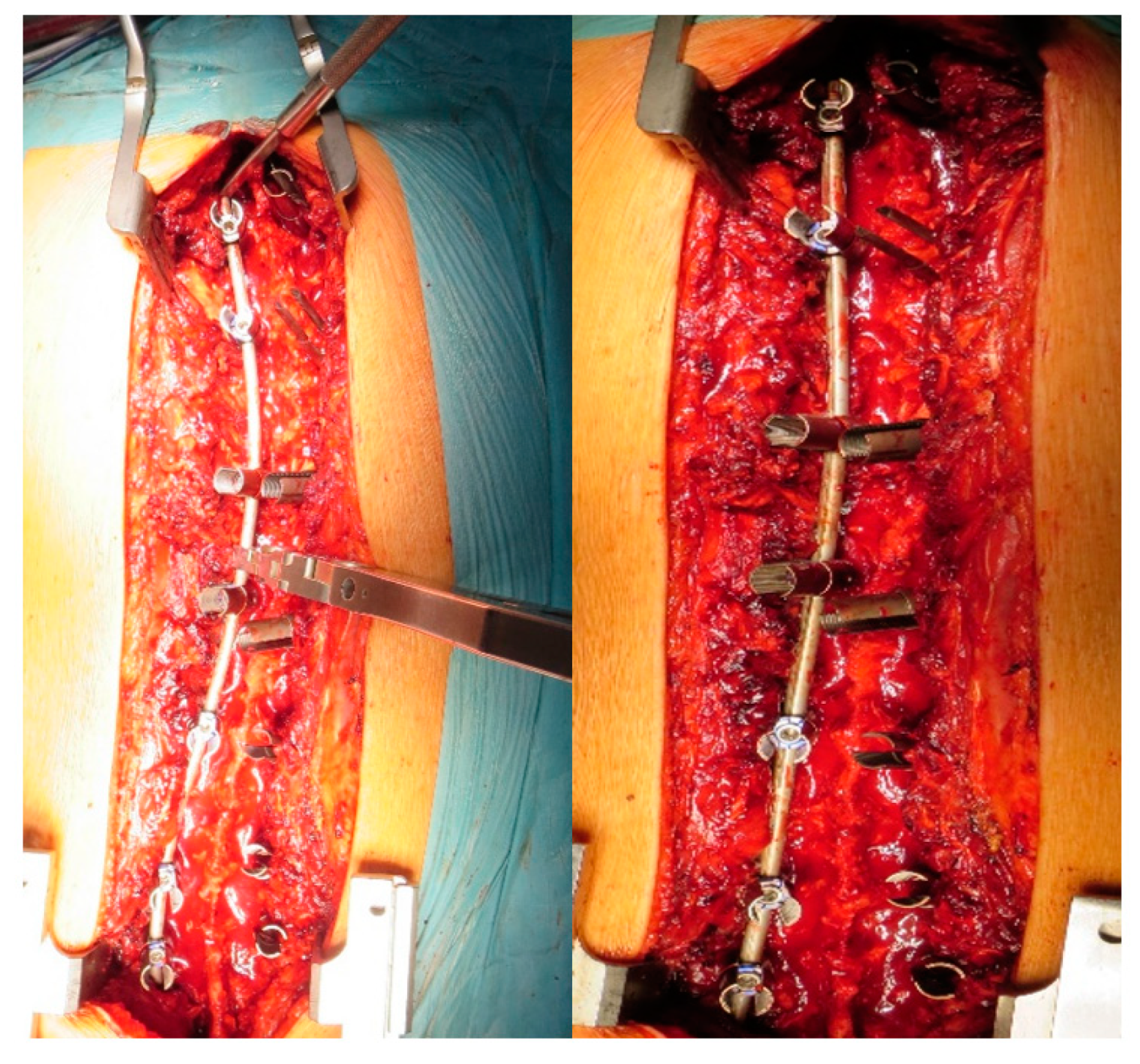 Jcm 12 00076 g003 Jcm 12 00076 g003