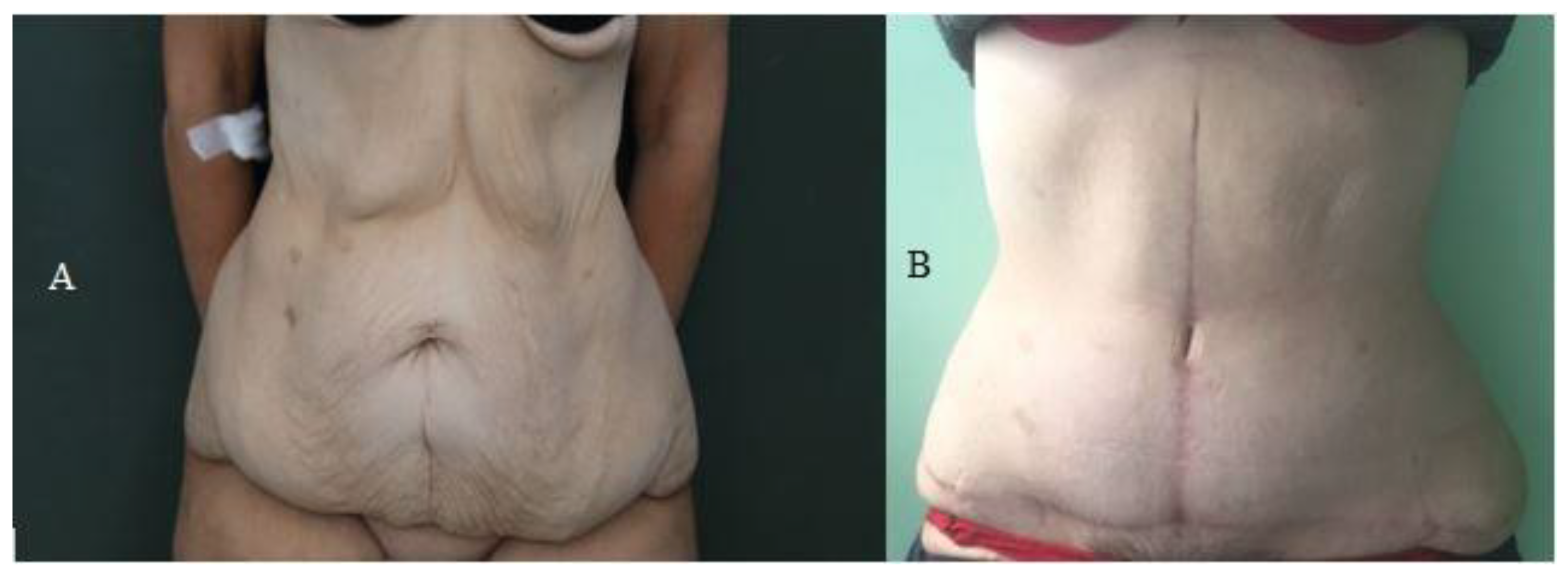 Jcm 12 00078 g006 Jcm 12 00078 g006