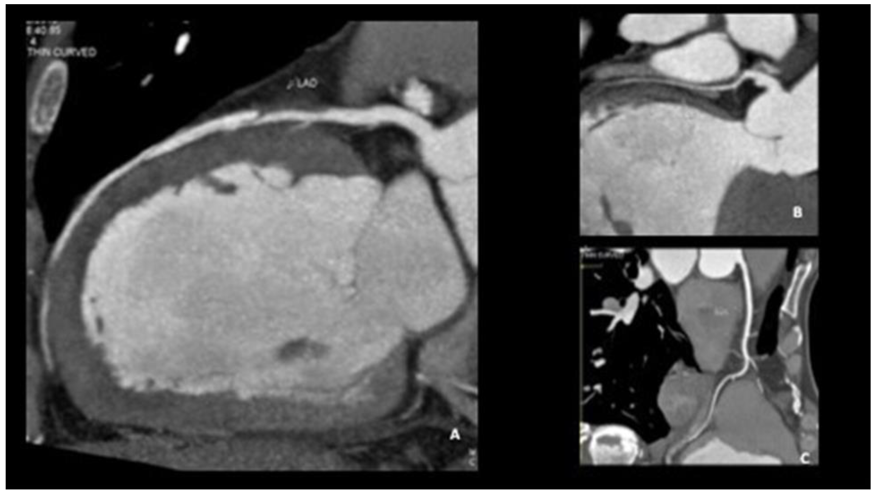 Jcm 12 00154 g004 Jcm 12 00154 g004