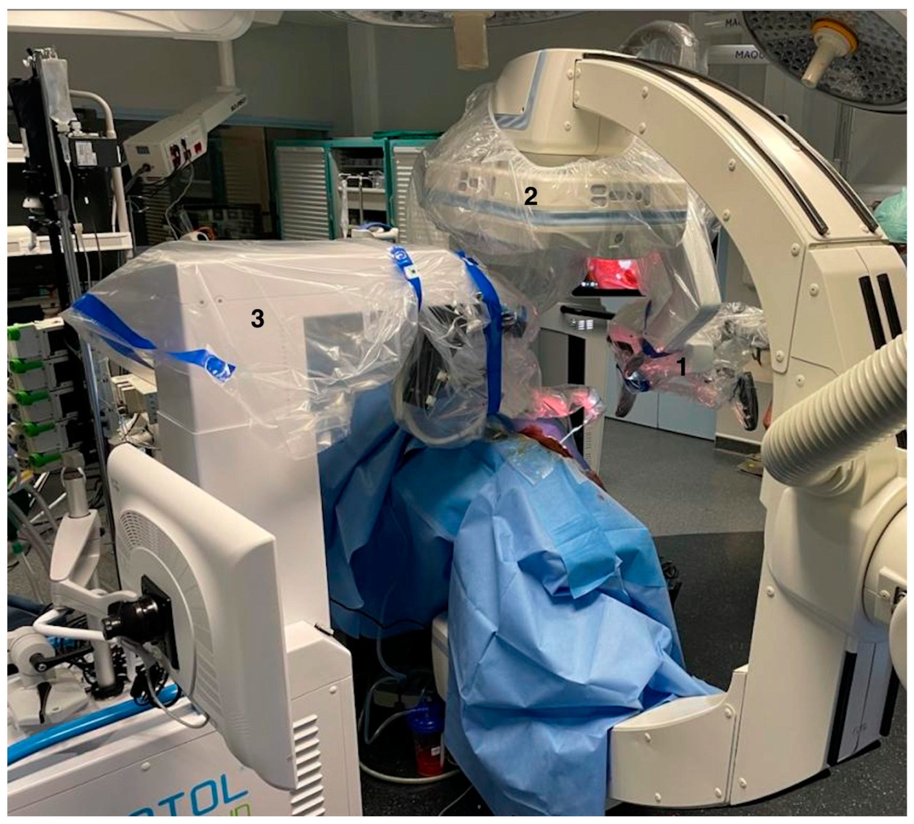 JCM Free Full-Text Robotized Cochlear Implantation under Fluoroscopy A Preliminary Series