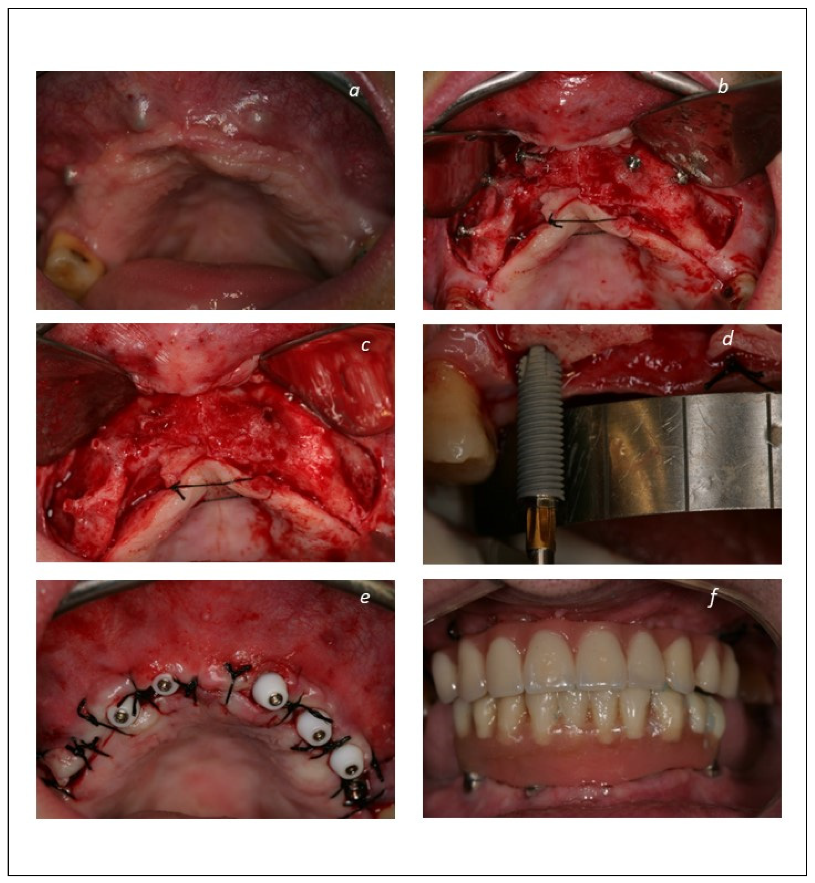 Jcm 12 00261 g002 Jcm 12 00261 g002