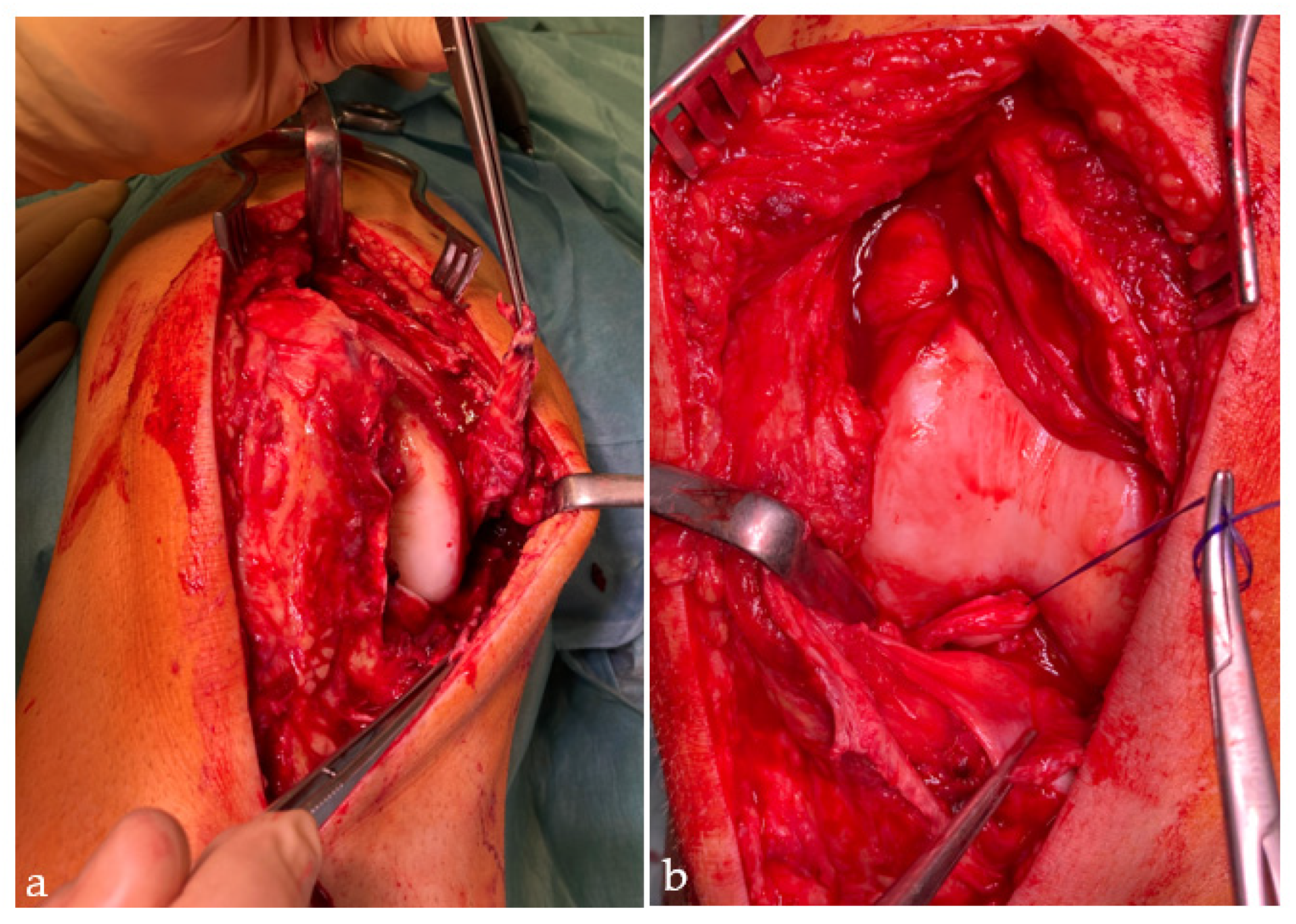 Jcm 12 00266 g002 Jcm 12 00266 g002