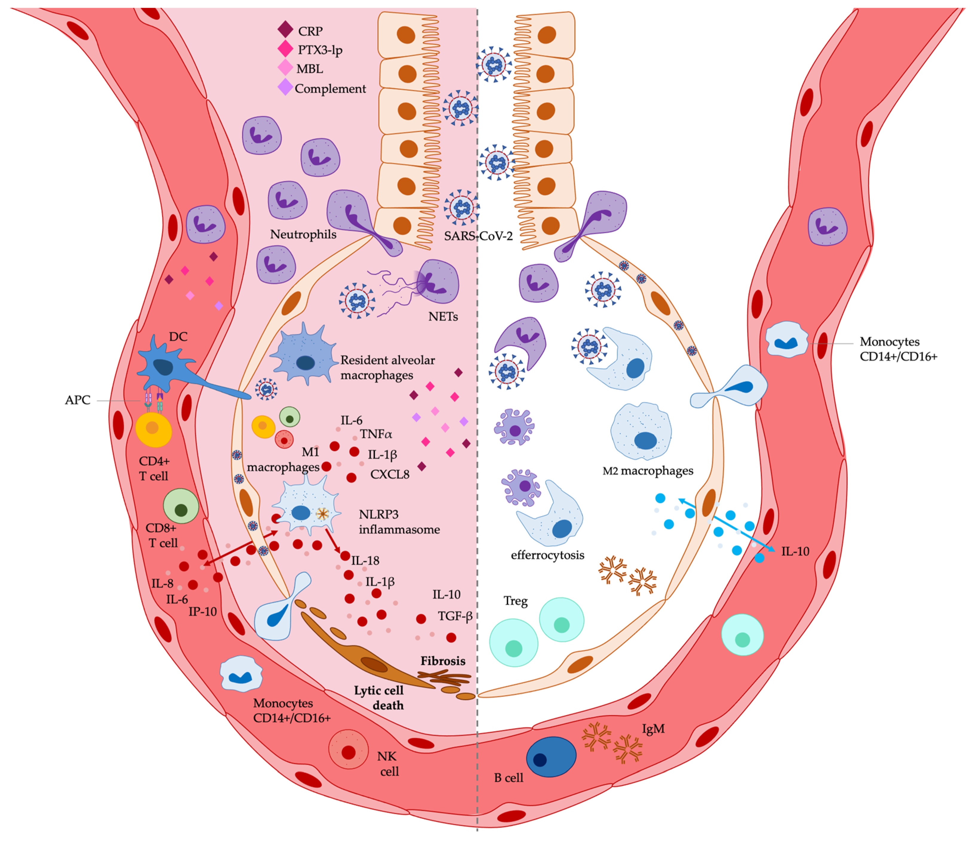 JCM | Free Full-Text | Omega-3 Polyunsaturated Fatty Acids (n-3 PUFAs) for  Immunomodulation in COVID-19 Related Acute Respiratory Distress Syndrome  (ARDS)