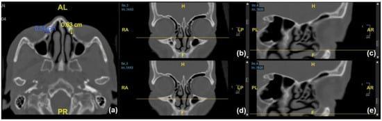 JCM | Free Full-Text | Computed Tomography Morphology of Affected ...