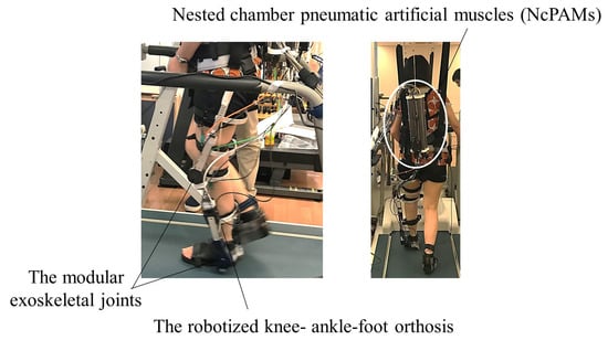 FUNCTIONAL KNEE BRACE ARTIFICIAL LOWER LIMB - ANKLE / FOOT SUPPORT