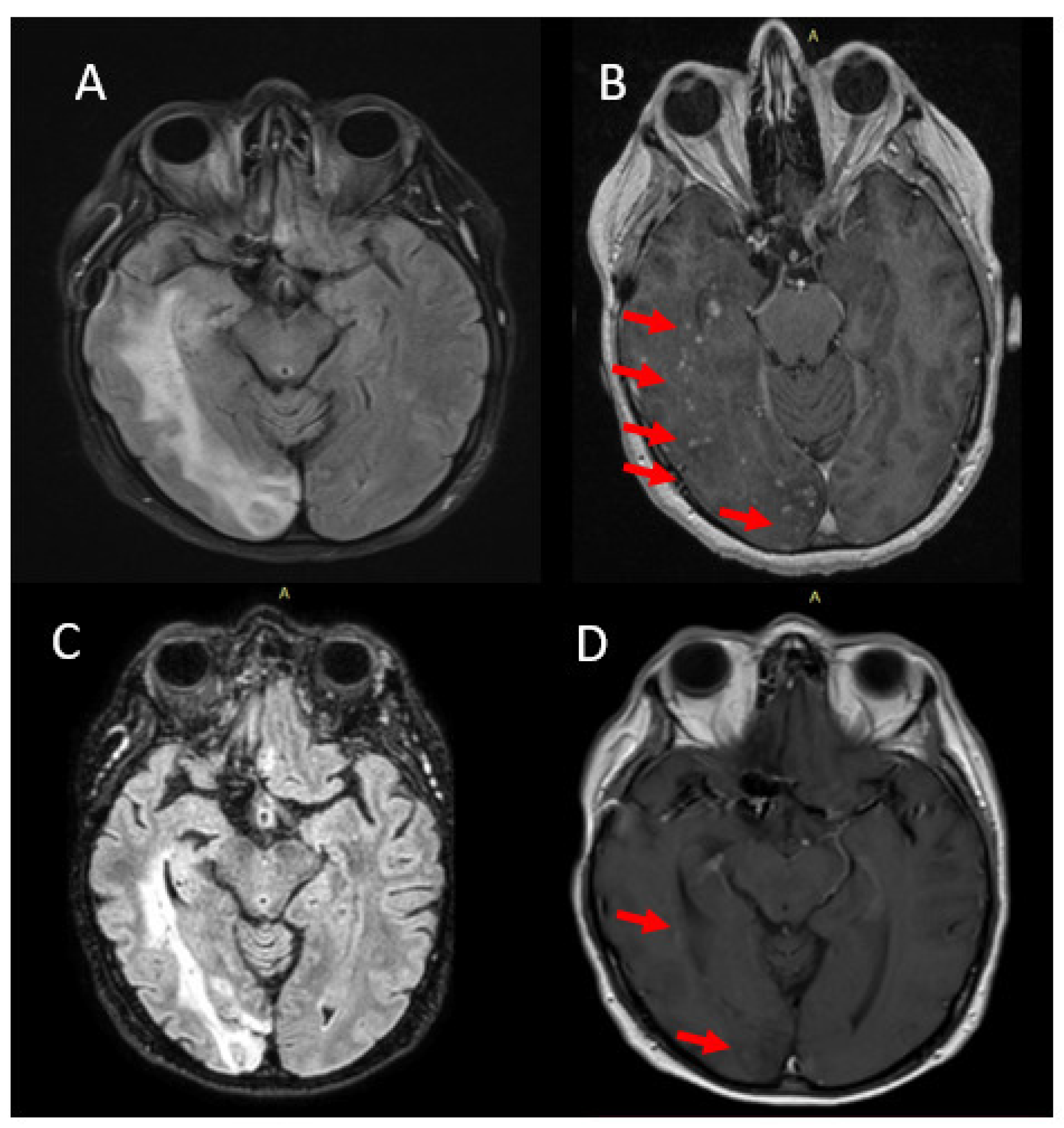 Jcm 12 00496 g003 Jcm 12 00496 g003