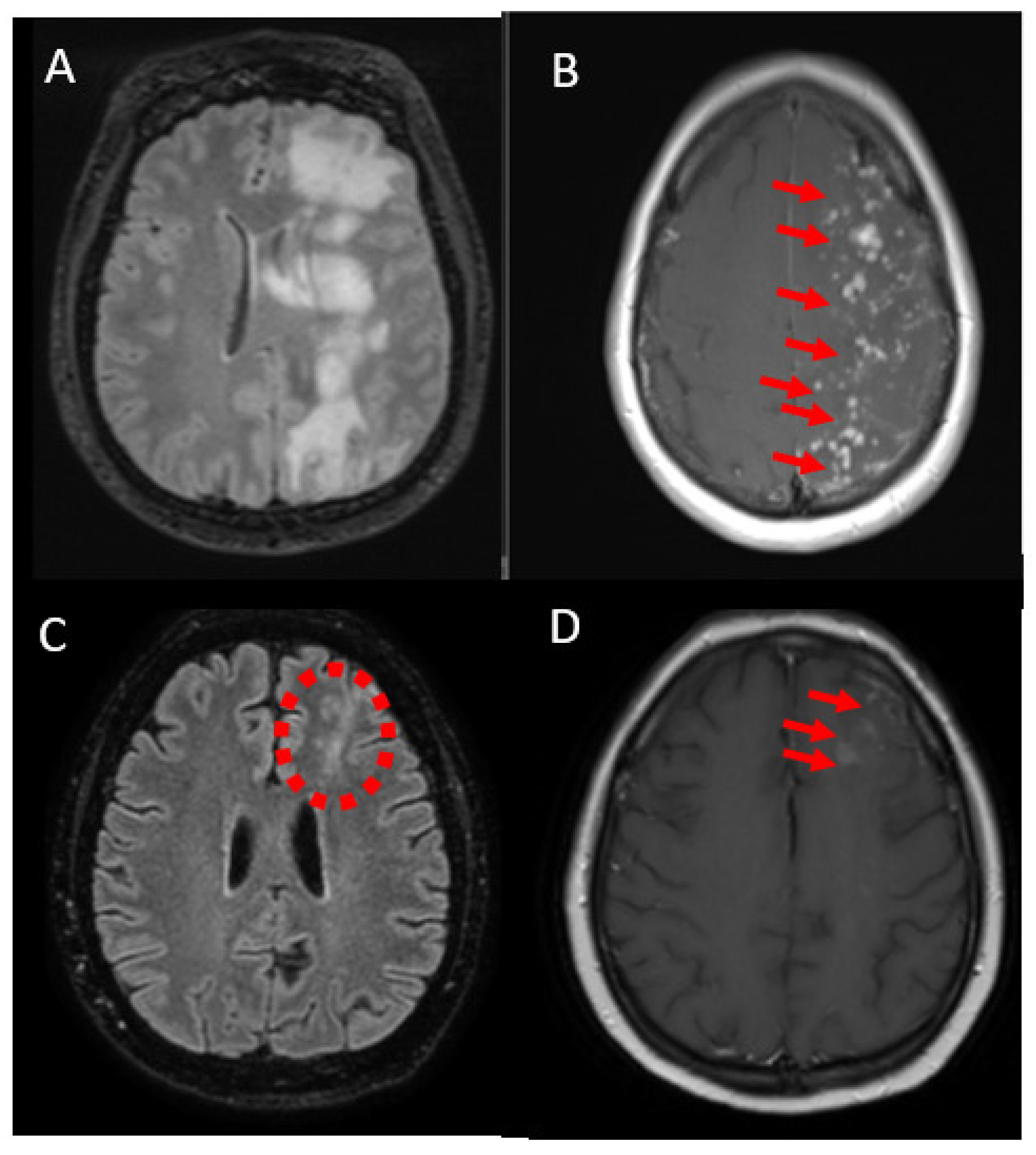 Jcm 12 00496 g004 Jcm 12 00496 g004