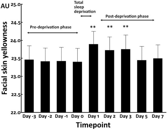 Deprivation Exercises, Ed Park