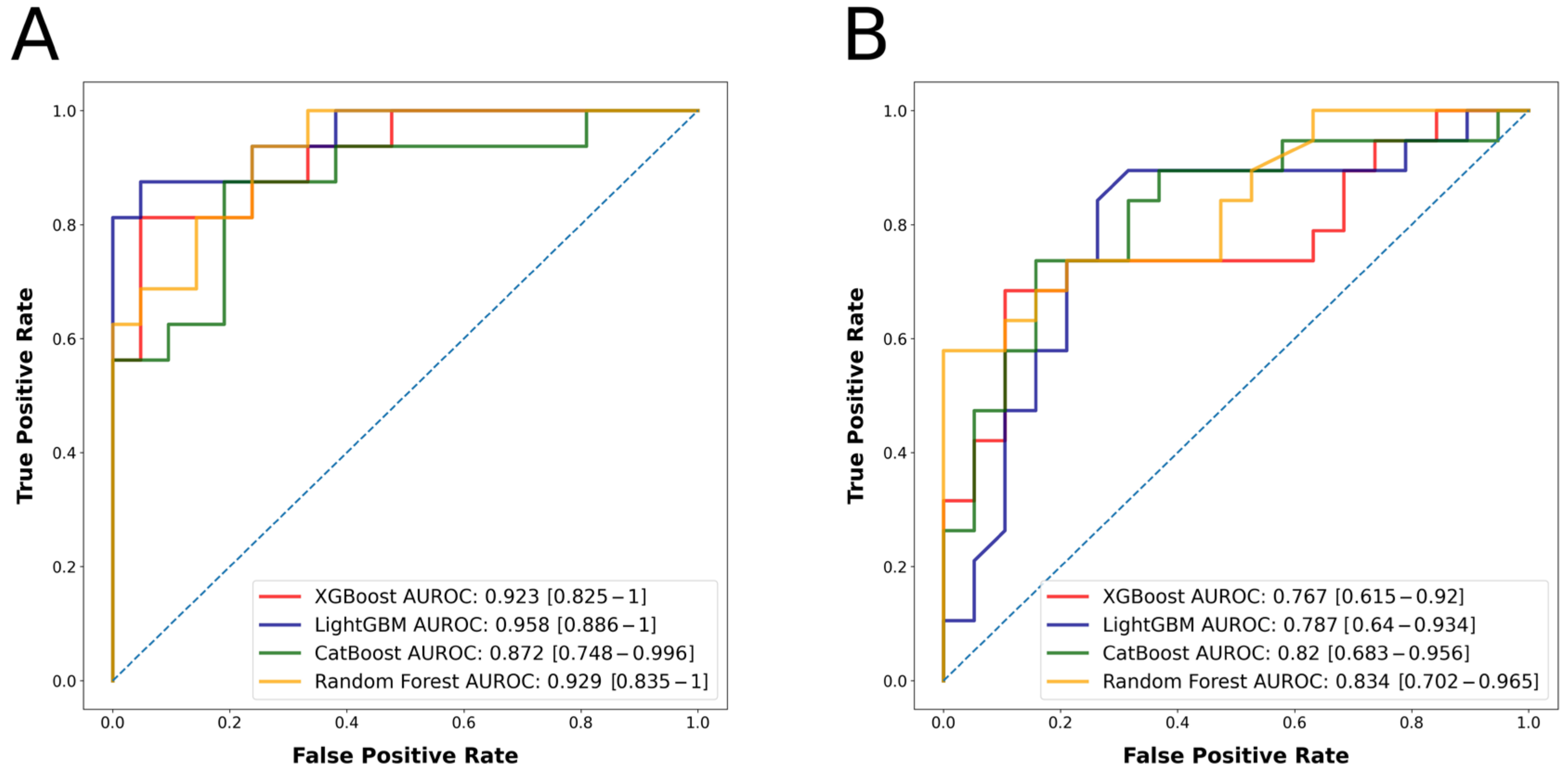 Acromegaly With Cardiomyopathy, Cardiac Thrombus and Hemorrhagic Cerebral  Infarct: A Case Report of Therapeutic Dilemma With Review of Literature, International Journal of Endocrinology and Metabolism