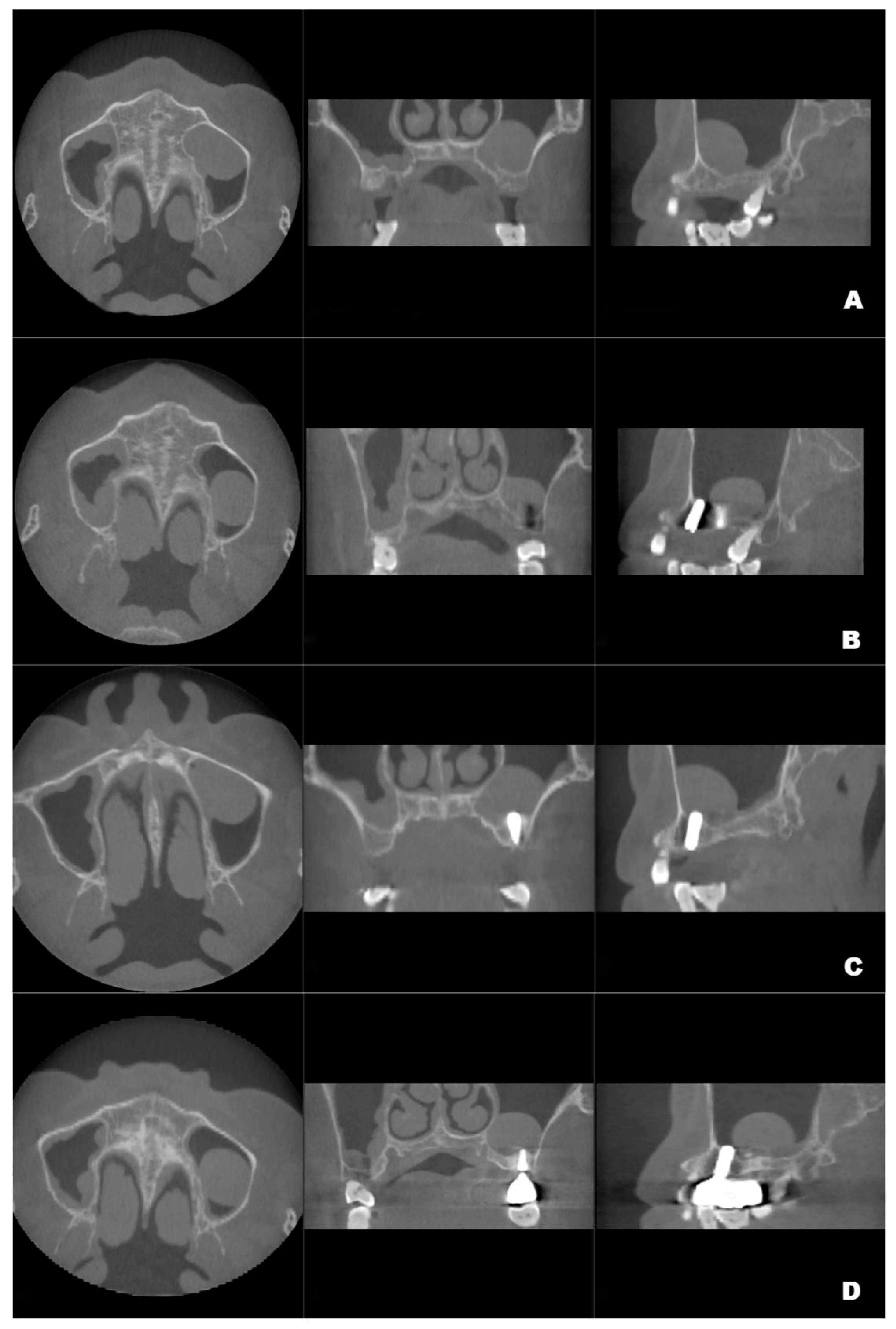 Jcm 12 00920 g003 Jcm 12 00920 g003