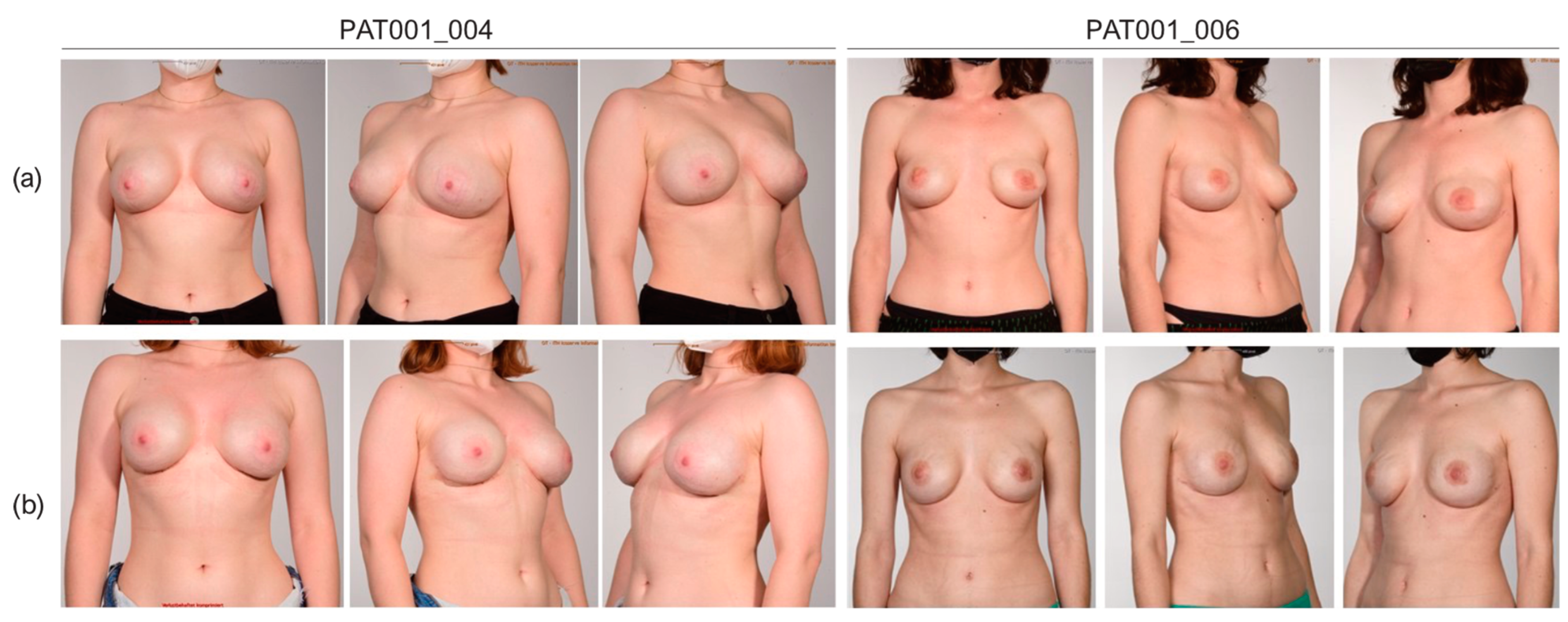 Jcm 12 01315 g005 Jcm 12 01315 g005