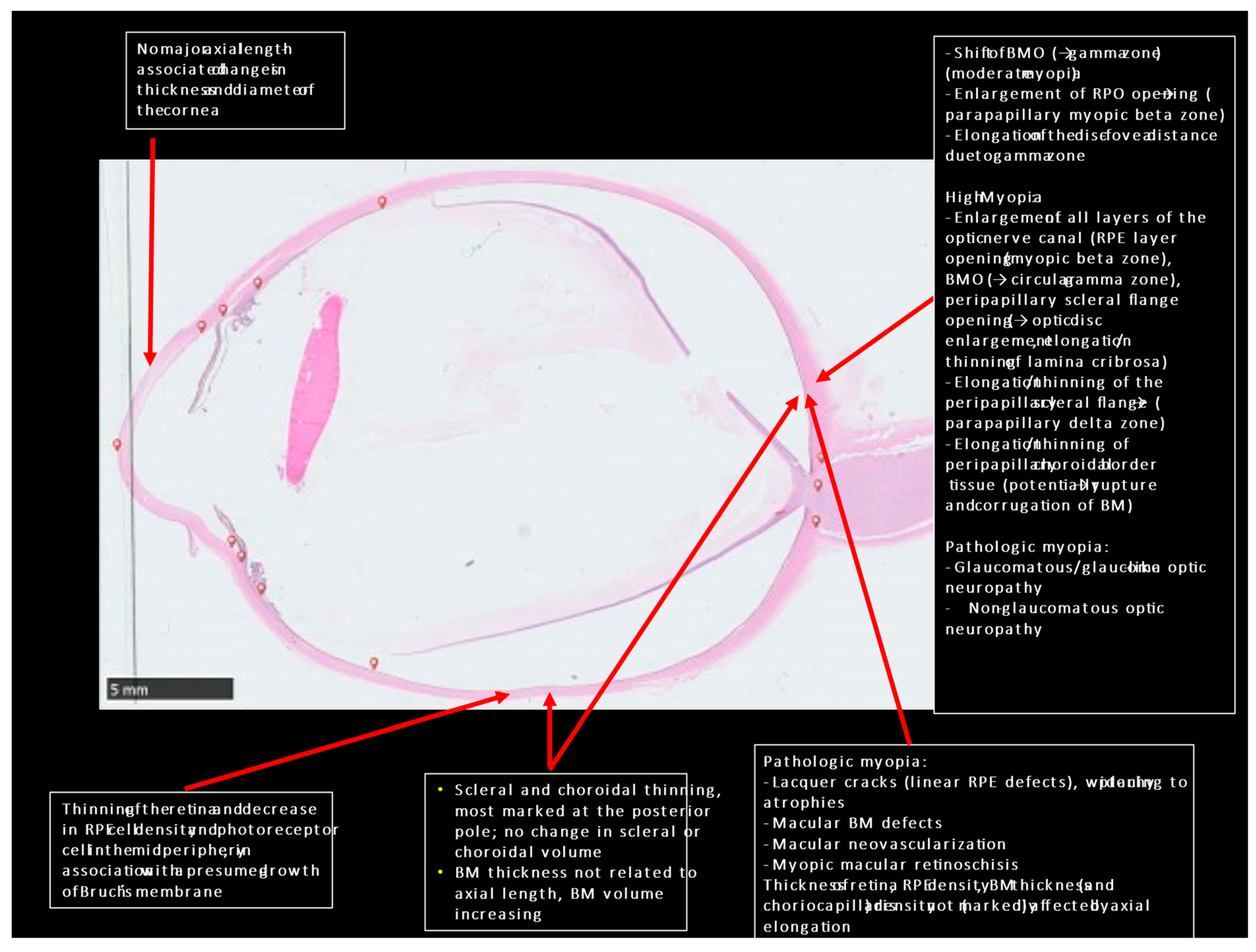 JCM | Free Full-Text | Anatomic Peculiarities Associated with