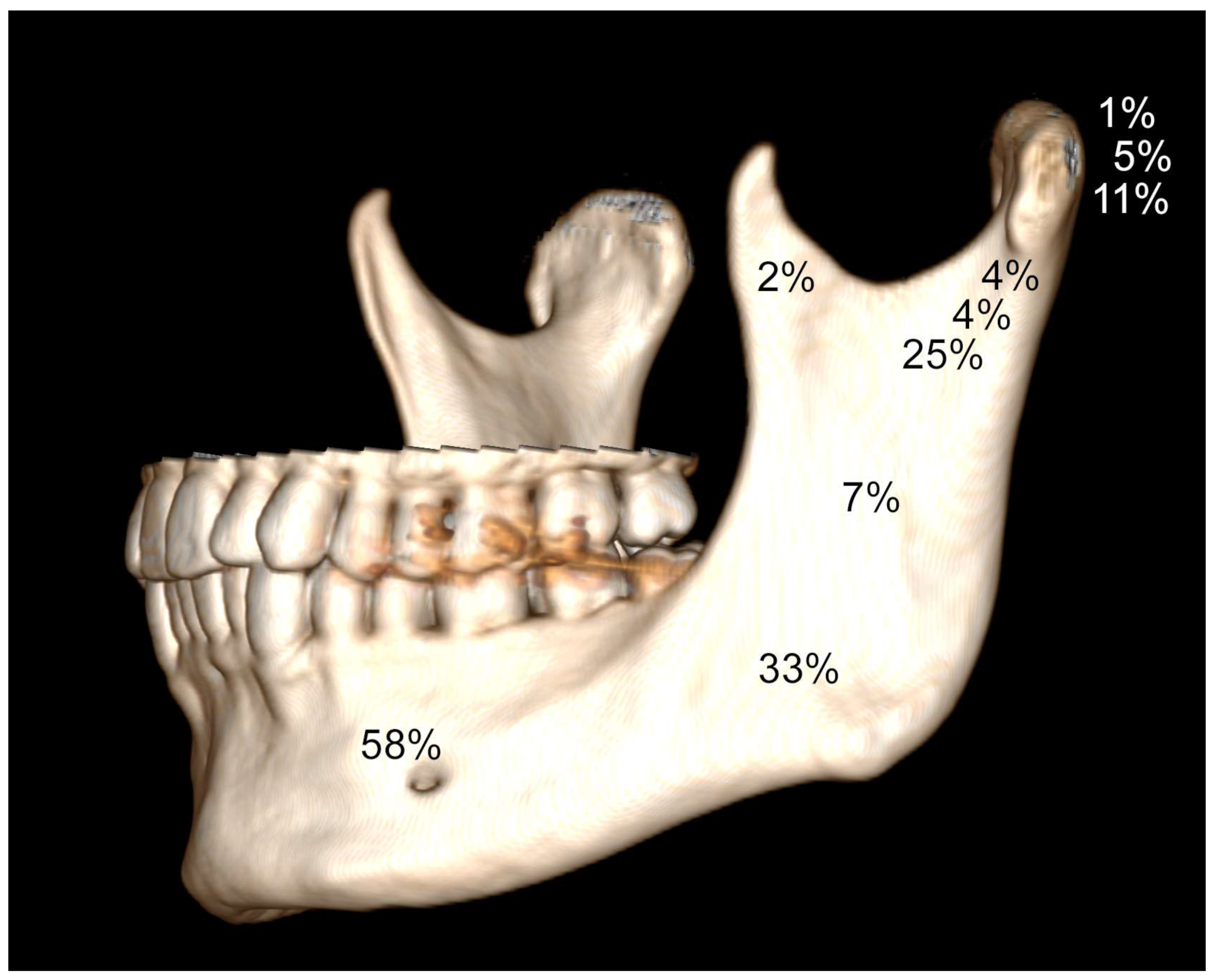 condyloid process and mandibular condyle
