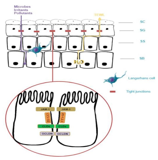 JCM | Free Full-Text | The Role of Tight Junctions in Atopic Dermatitis ...