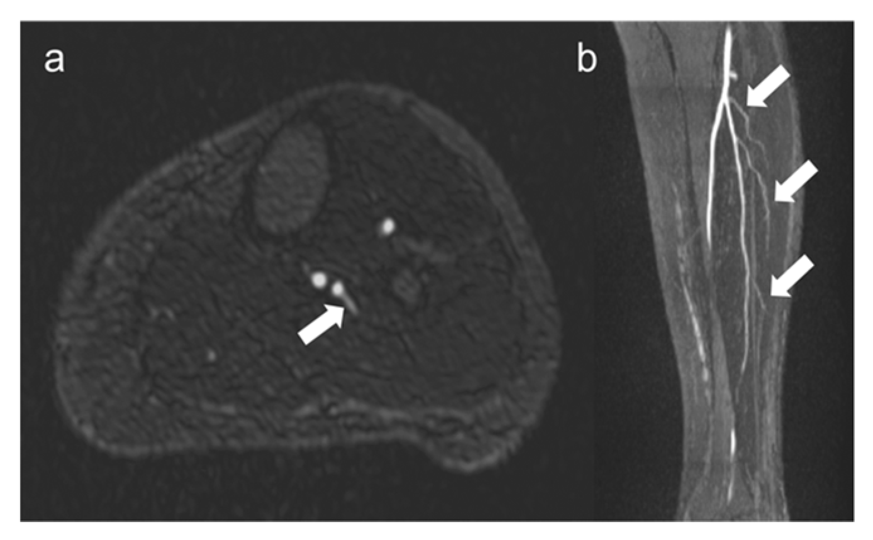 Jcm 12 01634 g004 Jcm 12 01634 g004