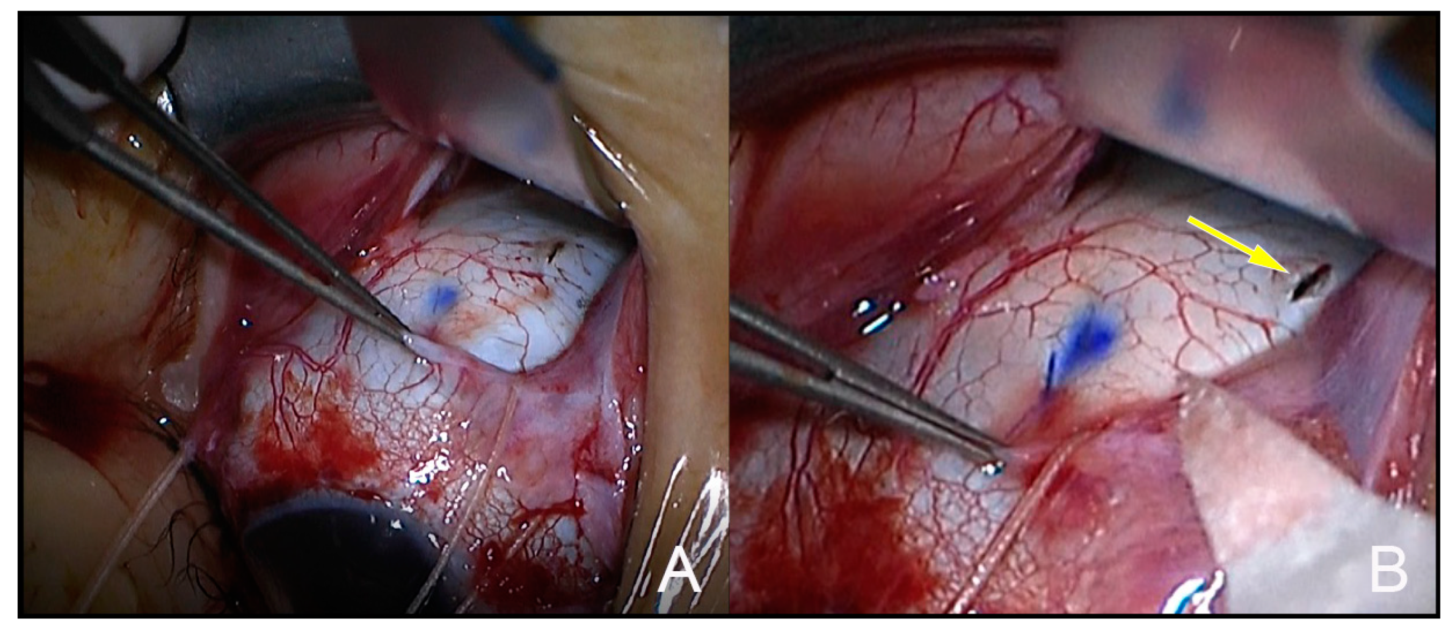 Jcm 12 01728 g003 Jcm 12 01728 g003