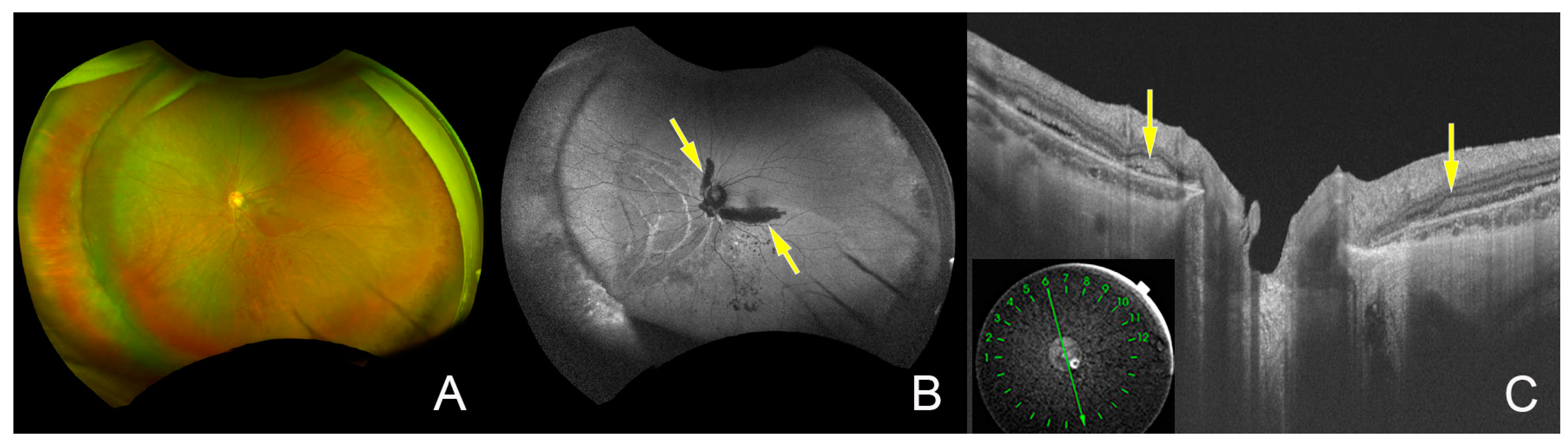 Jcm 12 01728 g004 Jcm 12 01728 g004