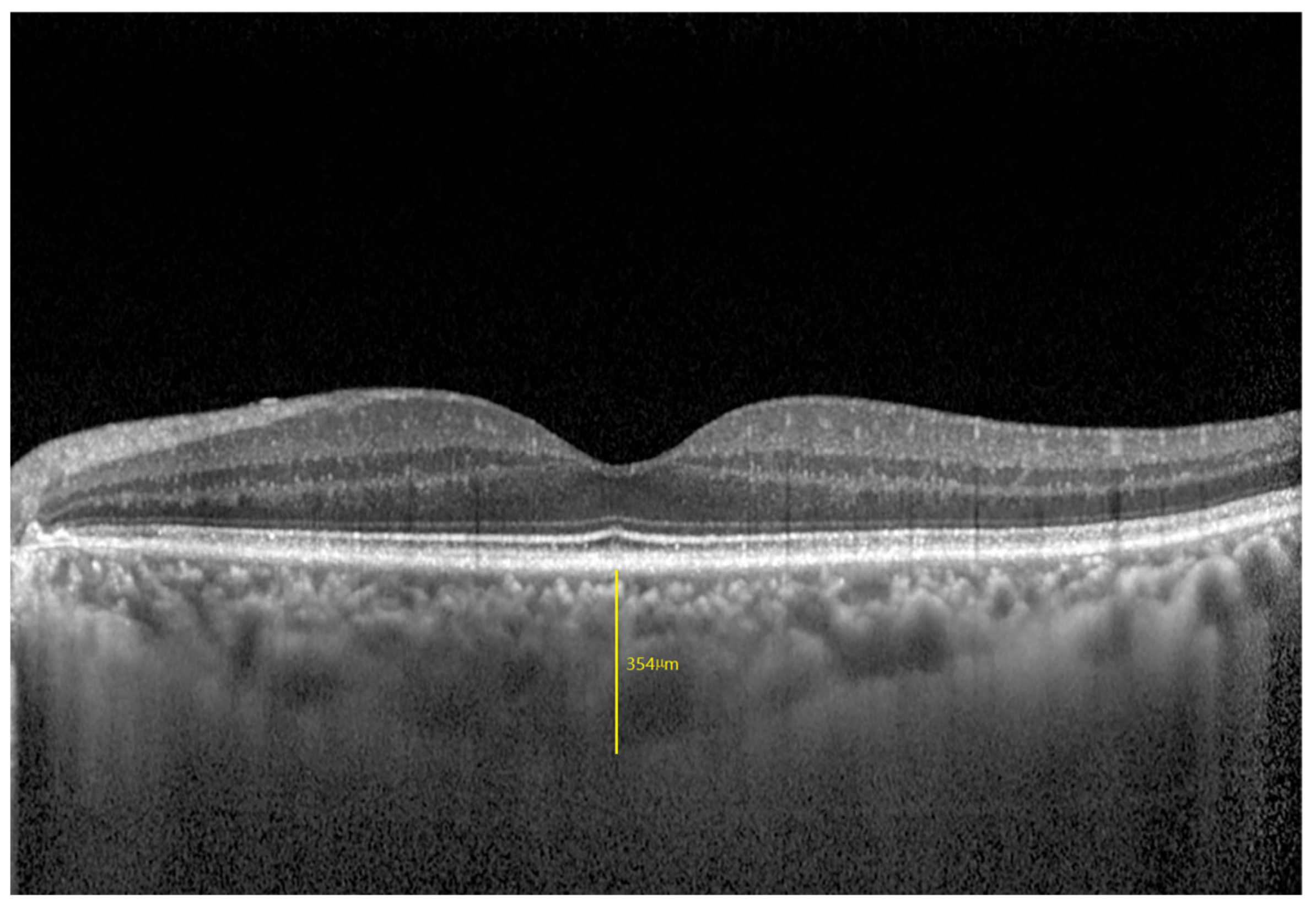 Jcm 12 01911 g001 Jcm 12 01911 g001