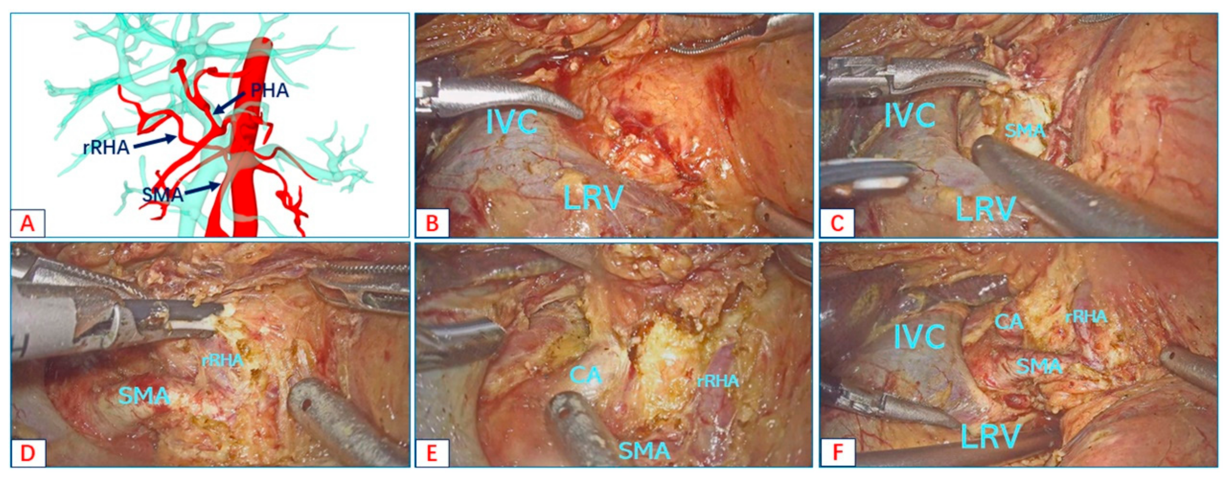 Jcm 12 01965 g002 Jcm 12 01965 g002