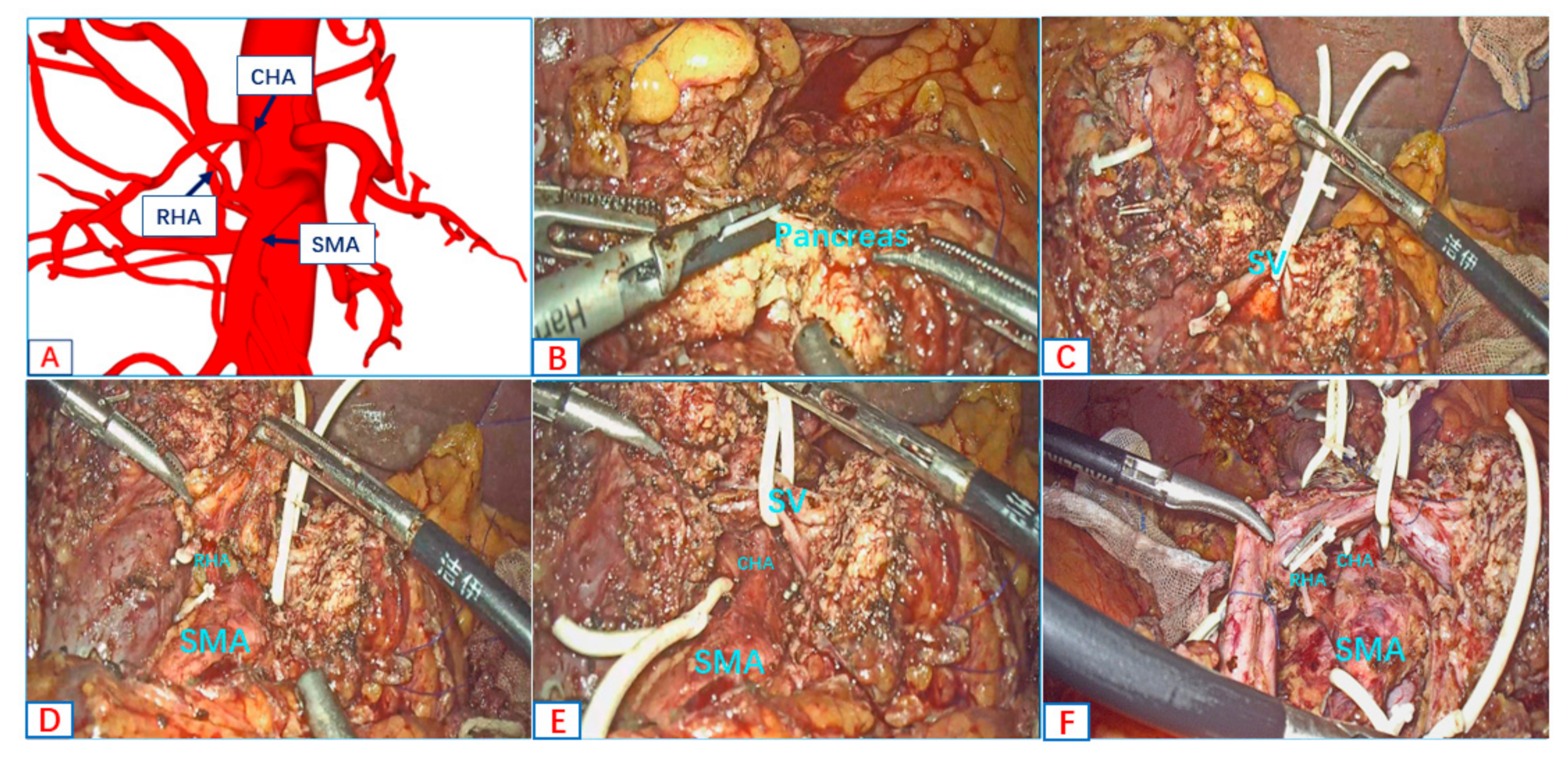 Jcm 12 01965 g003 Jcm 12 01965 g003